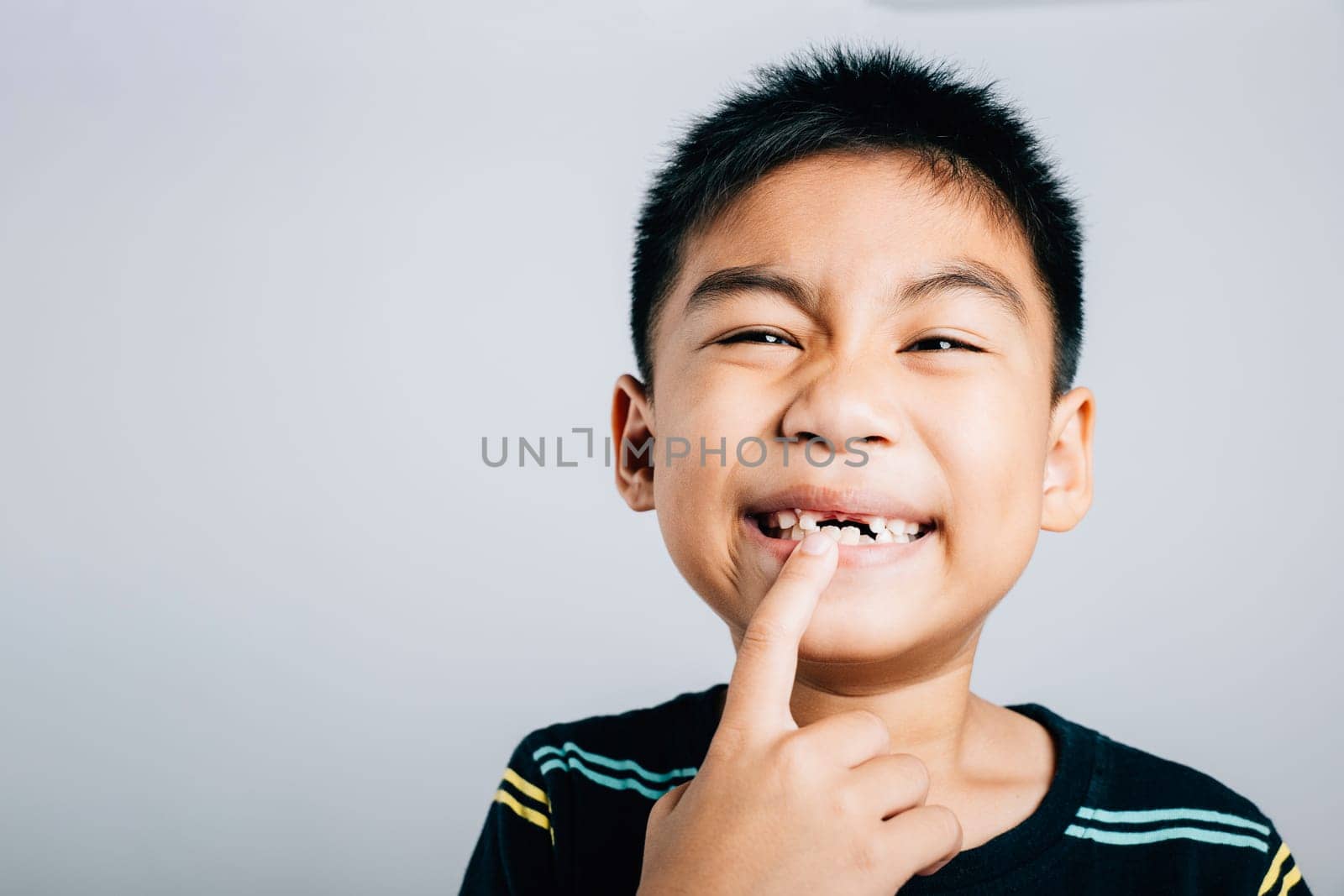 Adorable boy six smiling wide points to first permanent molar gap. cheerful portrait showcasing child dental growth exfoliation and happy phase of losing baby teeth. teeth new gap dentist problems by Sorapop