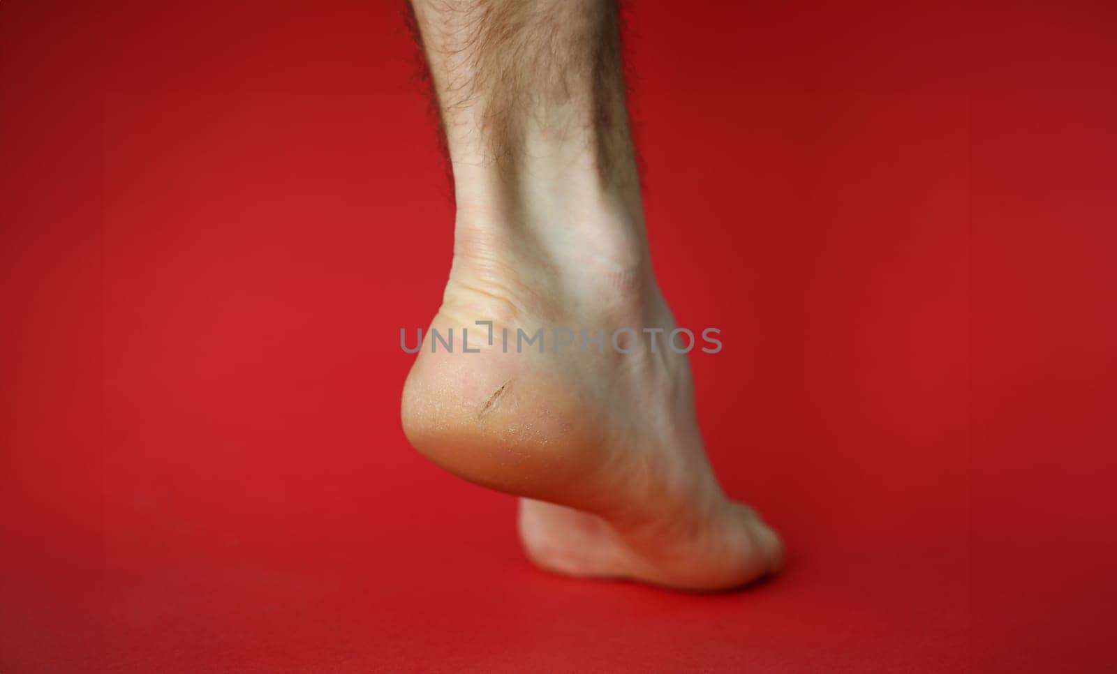 Close-up of heel of foot with bad skin covered with cracks. Female gam exposed to camera on lower view angle. Moisturizing cream advertisement concept. Isolated on red background