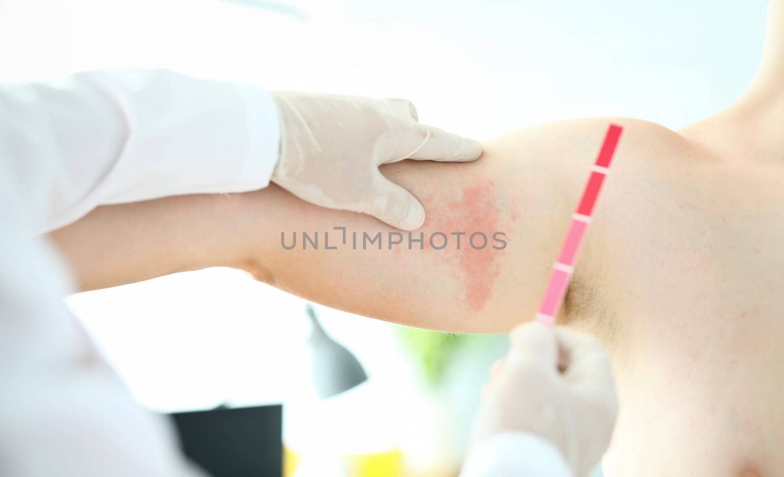 Focus on hardworking male hands in special medical gloves with spectrum inspecting painful sore on body of suffering patient. Professional dermatology clinic advertisement concept. Blurred background