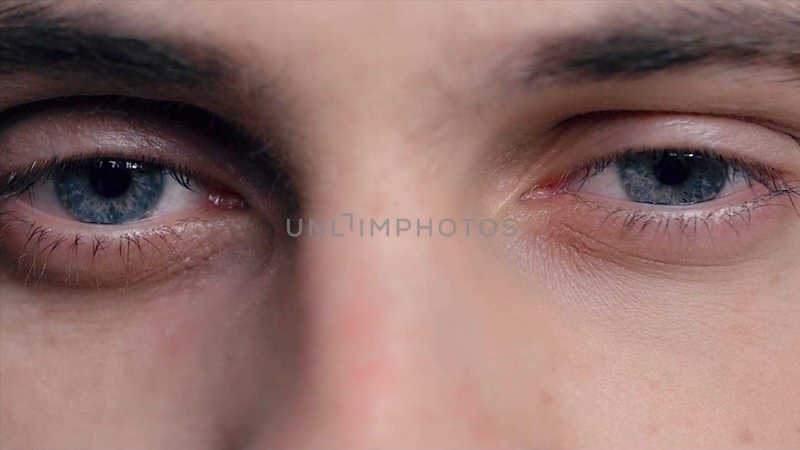 Closeup of young man's blue eyes with problematic skin acne and selective focus. Close-up portrait of a young man with blue eyes - OBS: model use lens contact. Human eye detail. Human eye close-up detail
