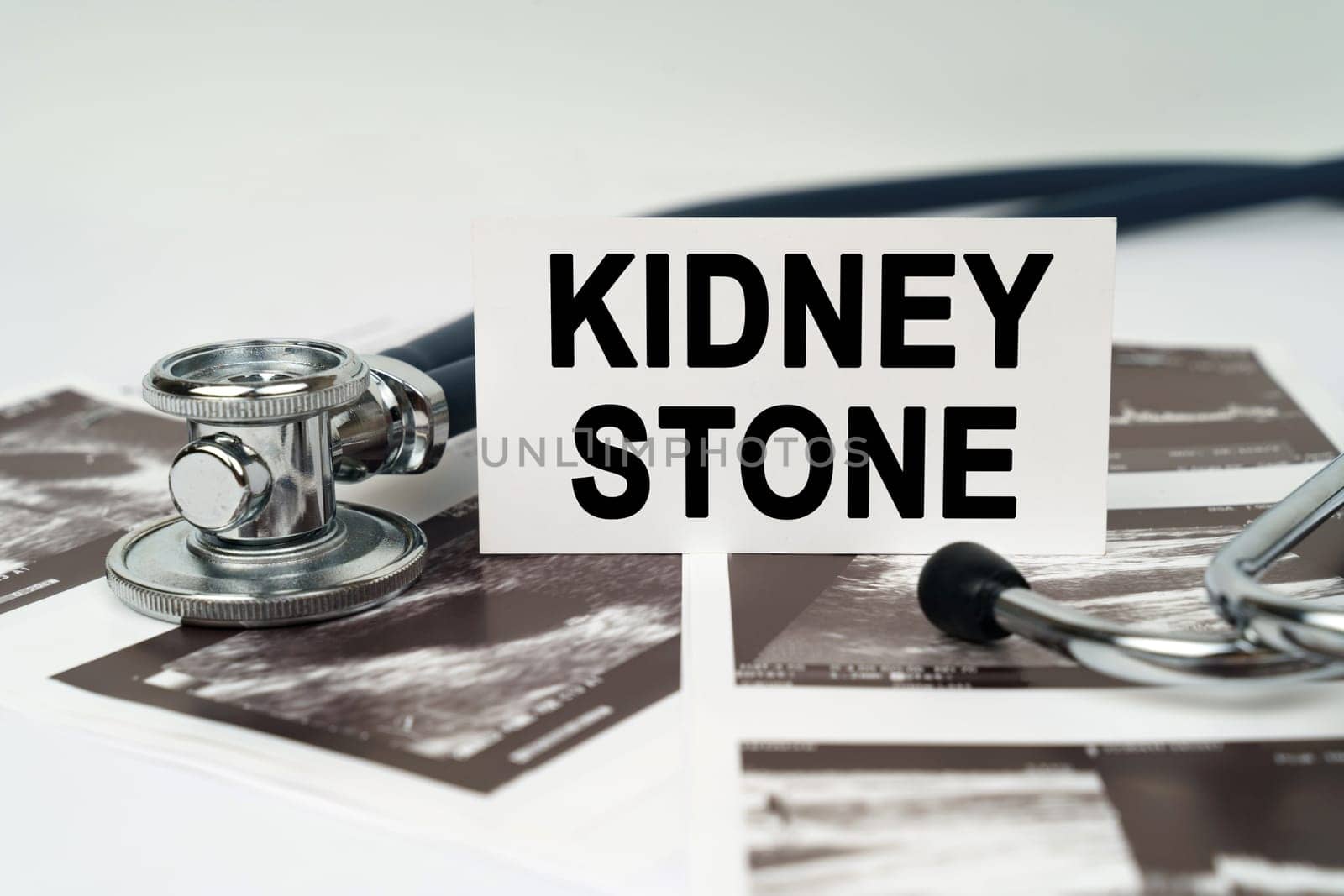 On the ultrasound pictures there is a stethoscope and a business card with the inscription - Kidney stone by Sd28DimoN_1976
