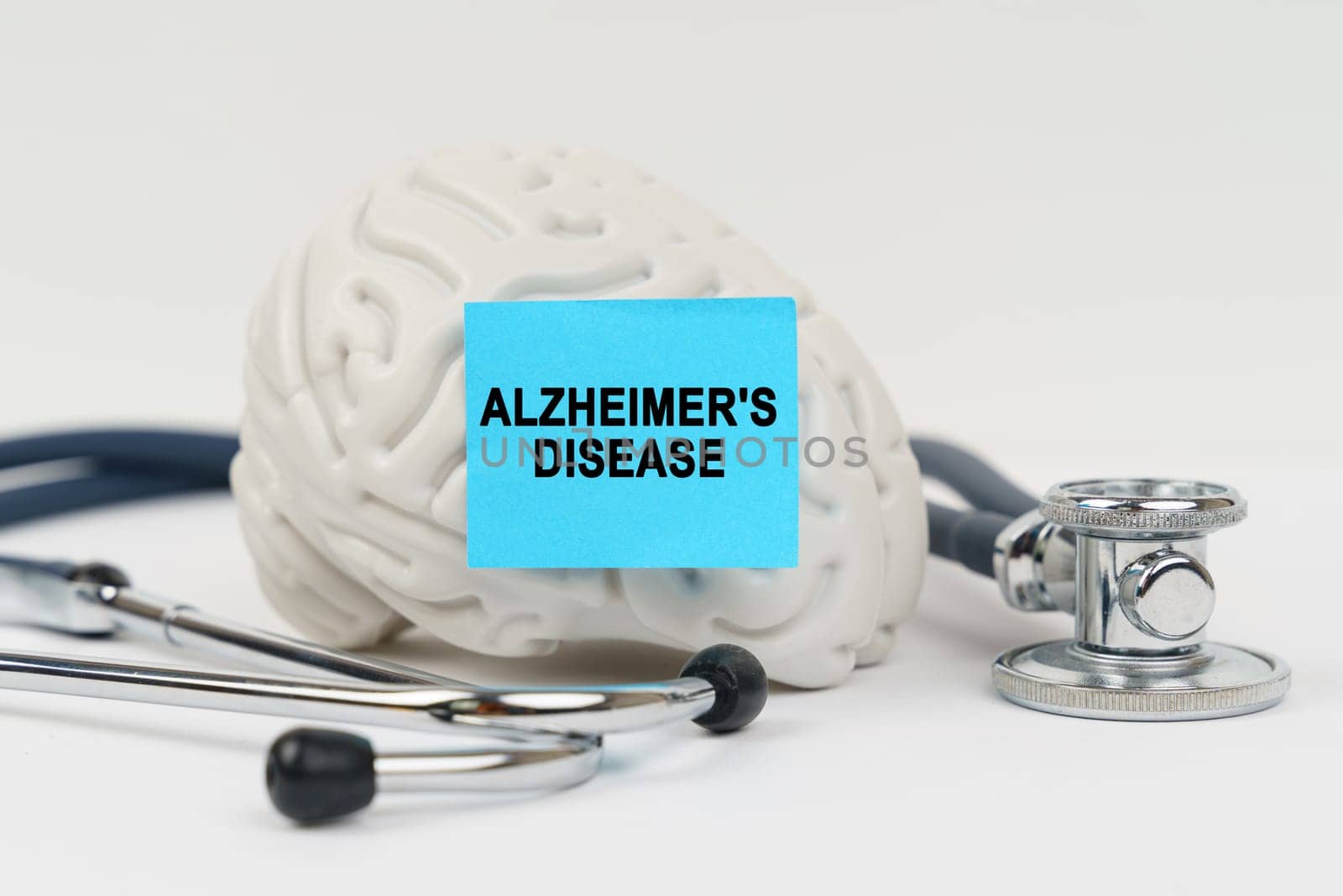 Medical concept. On a white surface next to the stethoscope lies a brain on which a sticker with the inscription - Alzheimers Disease