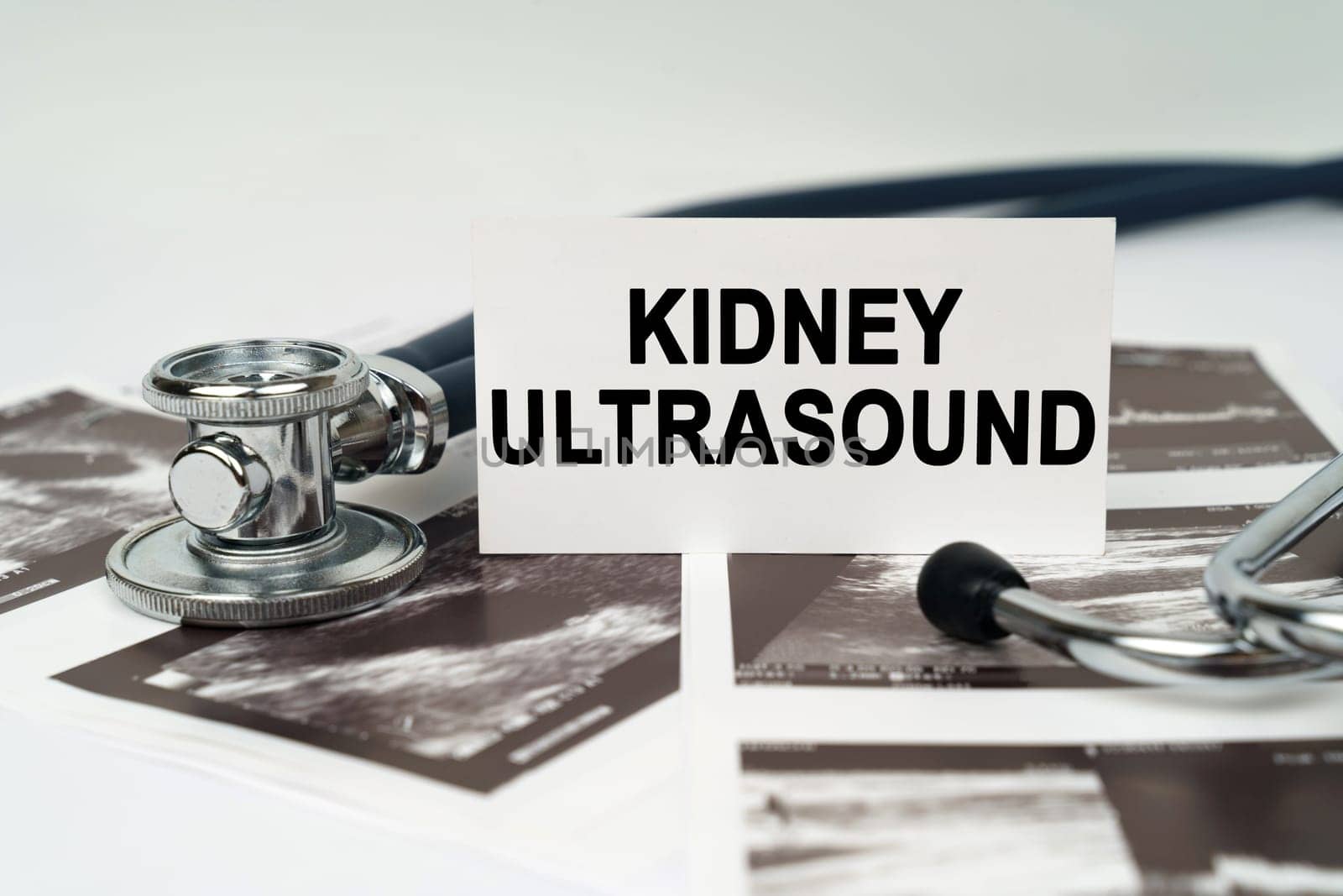 On the ultrasound pictures there is a stethoscope and a business card with the inscription - Kidney ultrasound by Sd28DimoN_1976