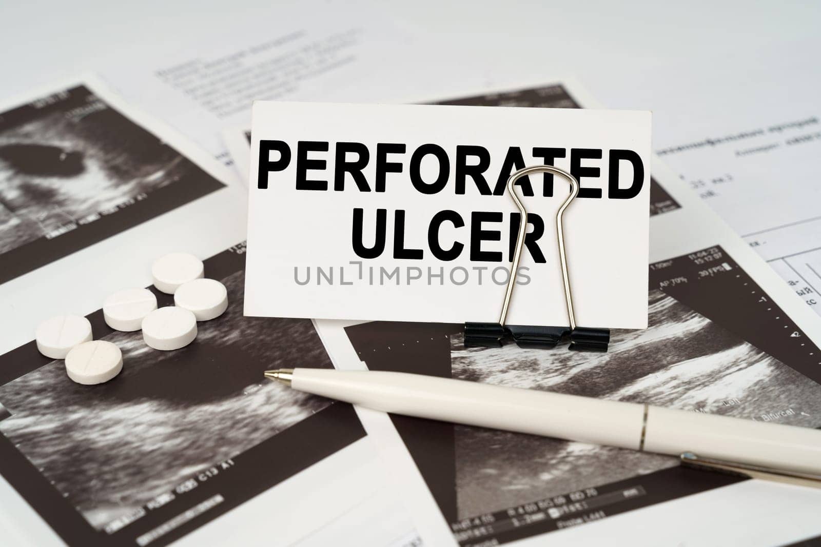 On the ultrasound pictures there is a pen and a business card with the inscription - Perforated ulcer by Sd28DimoN_1976