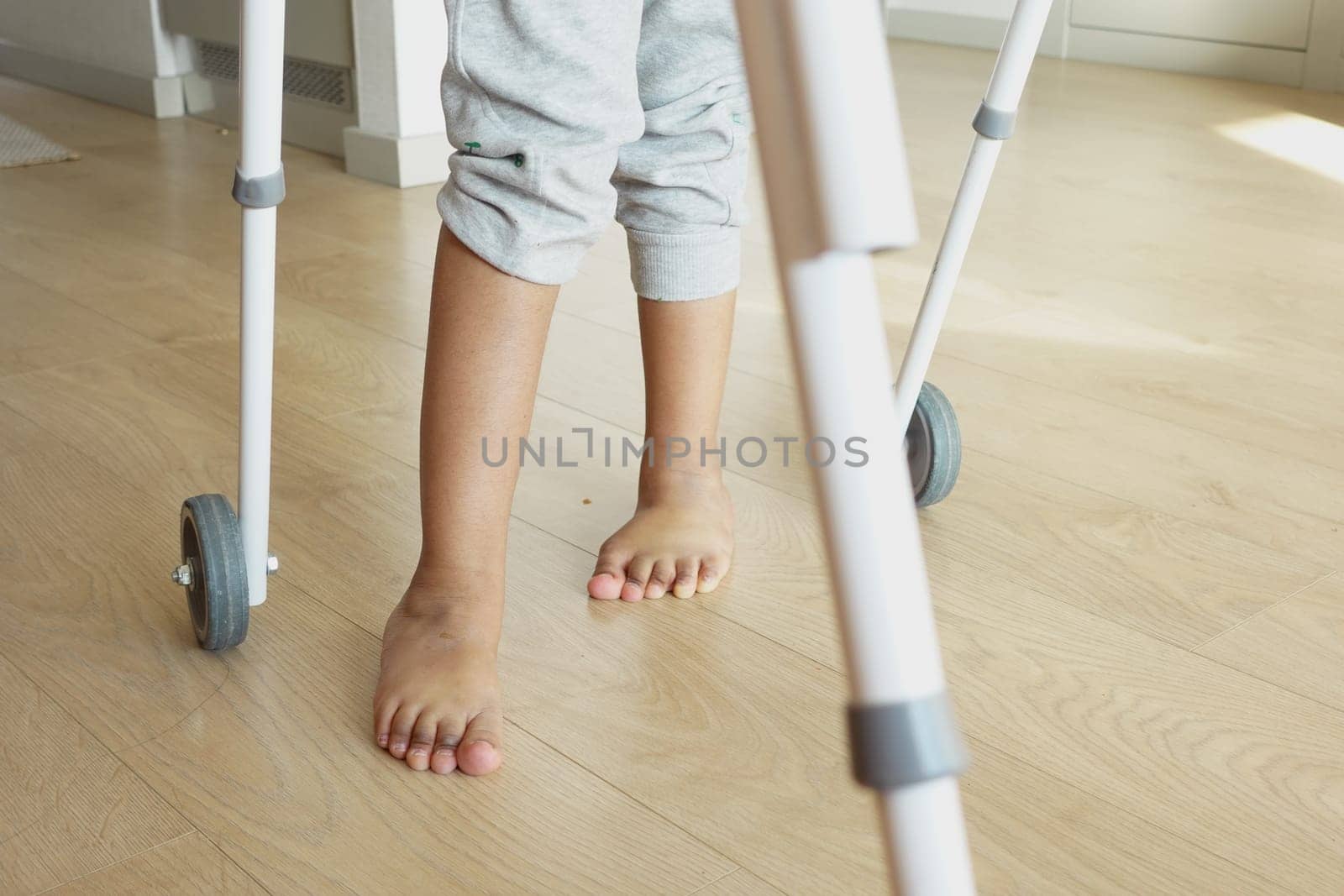 child with walking frame and knee orthosis indoor by towfiq007
