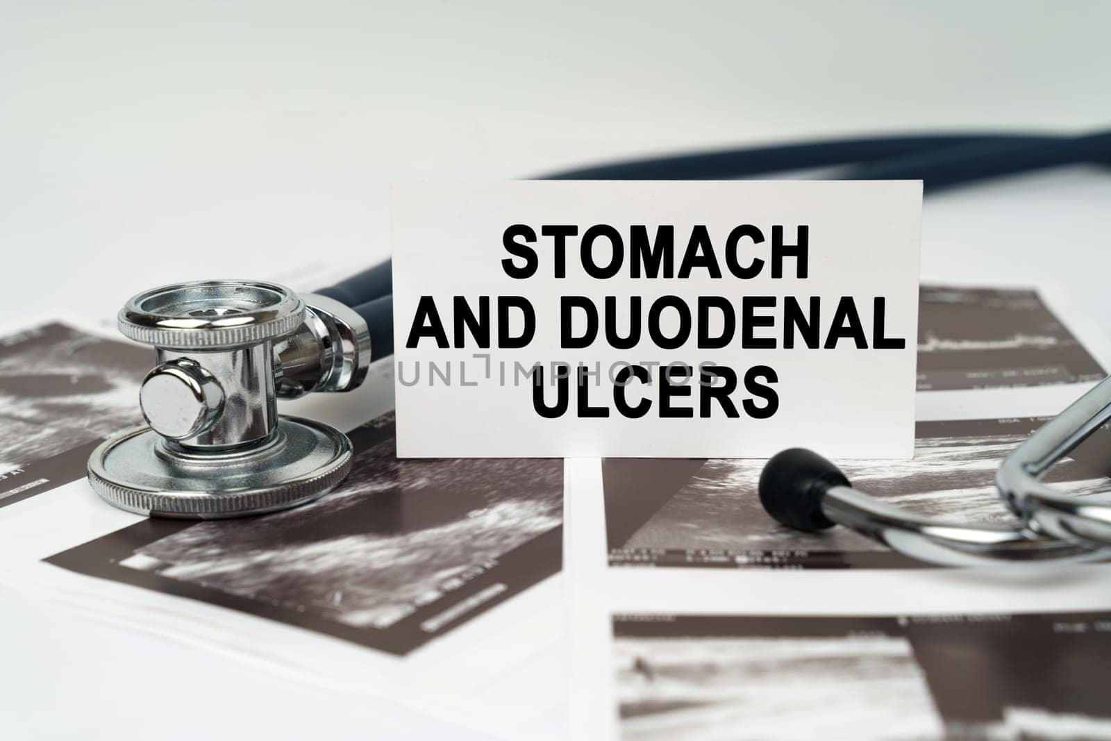 On the ultrasound pictures there is a stethoscope and a business card with the inscription - Stomach and duodenal ulcers by Sd28DimoN_1976