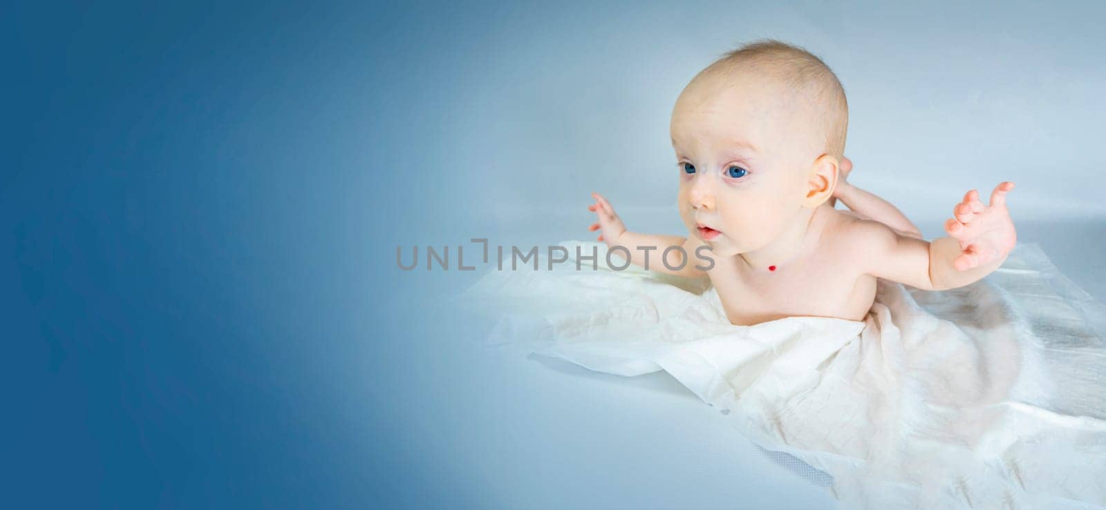 a baby with a hemangioma on his neck lies on a blue background. banner with a copy space. spread arms, the concept of flight
