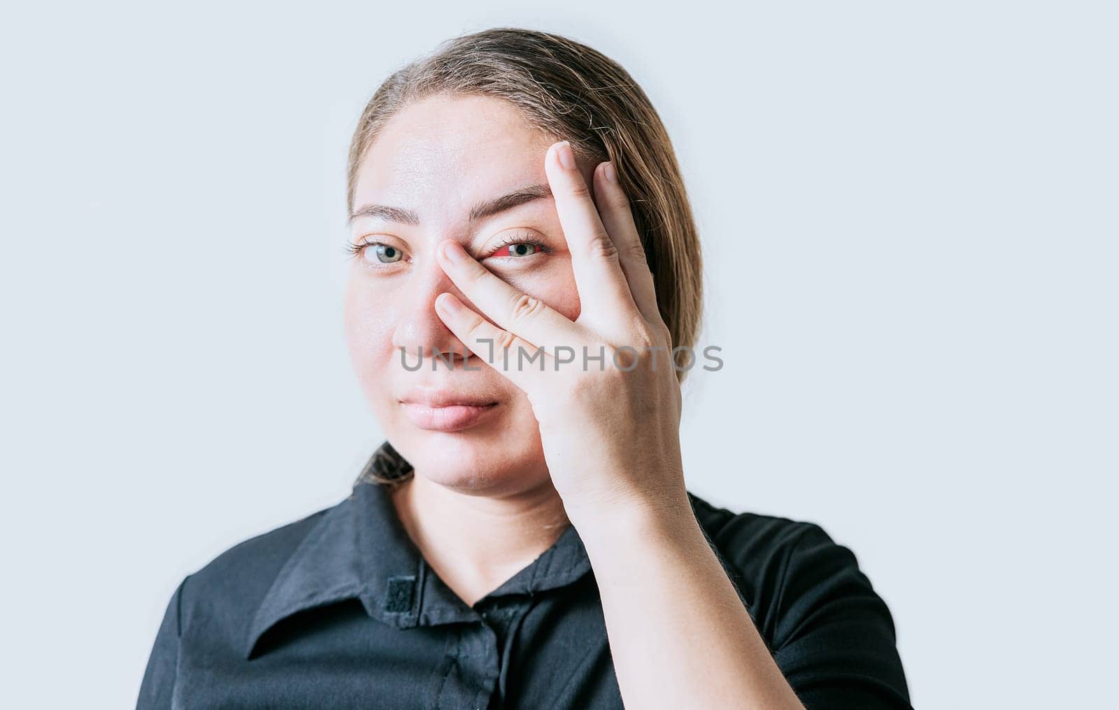 Person with irritated eyes. People with eye pain isolated. woman with conjunctivitis on white background. Close up of girl with eye strain by isaiphoto