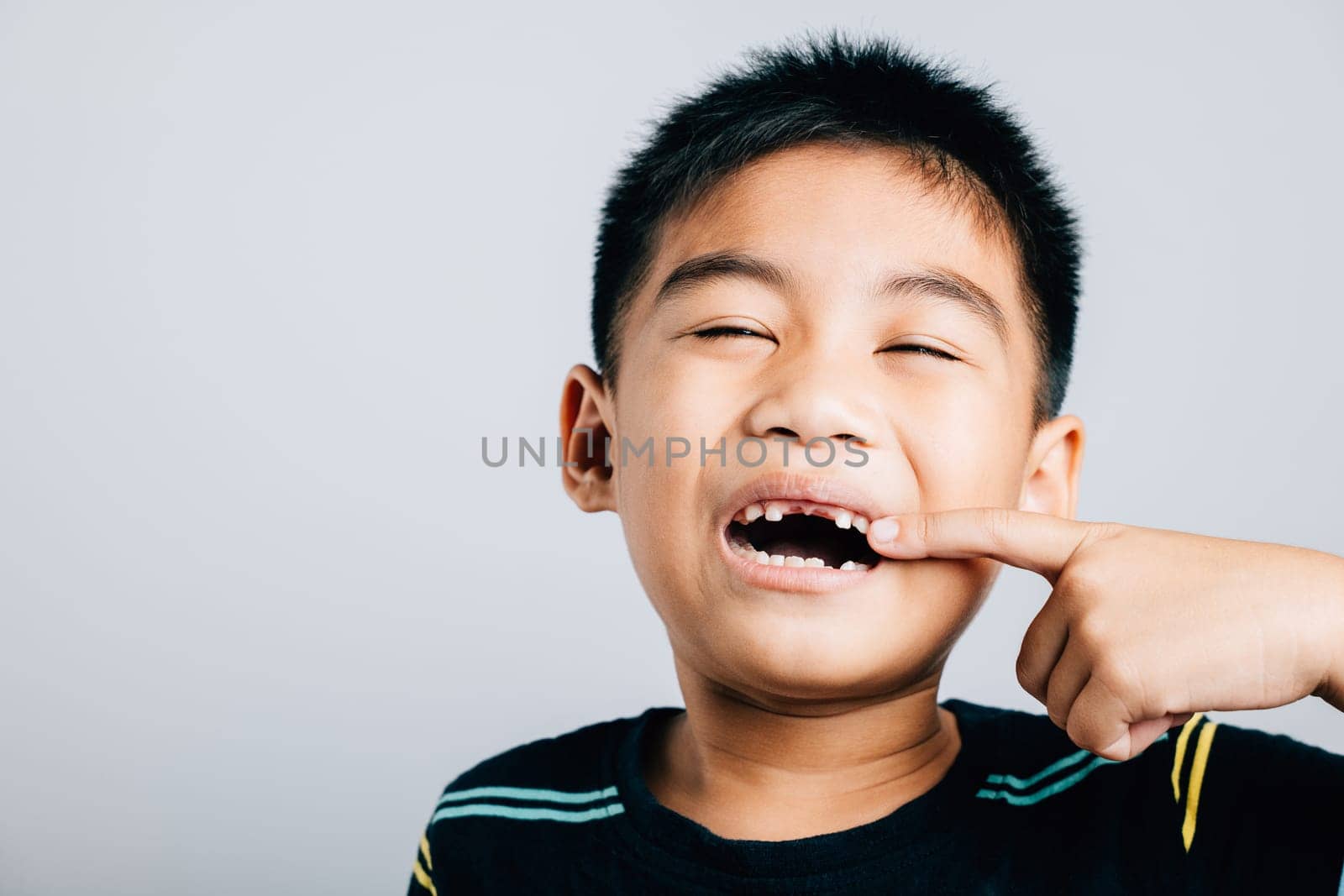 Asian boy missing front tooth illustrates dentistry and health care pointing to gap. Conceptual image isolated on white background emphasizing dental growth and care. teeth new gap, dentist problems by Sorapop