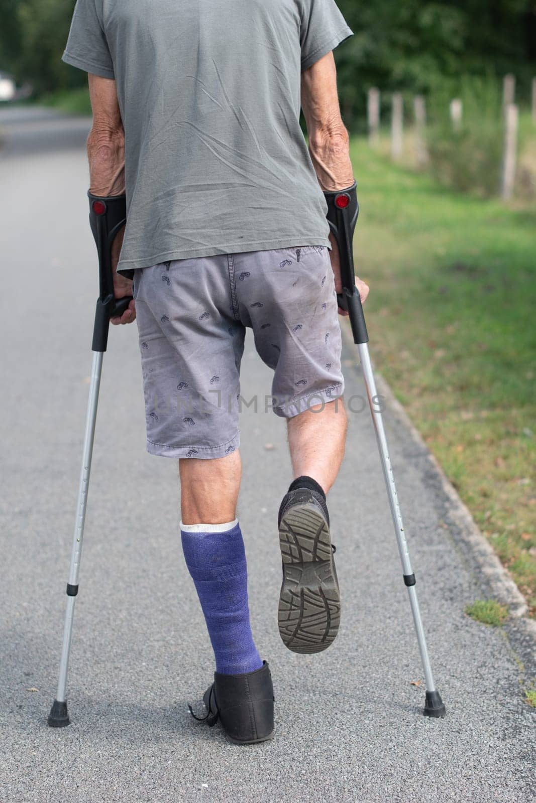 A man with a broken leg is walking down the street, on his left leg he has a special boot for walking by KaterinaDalemans