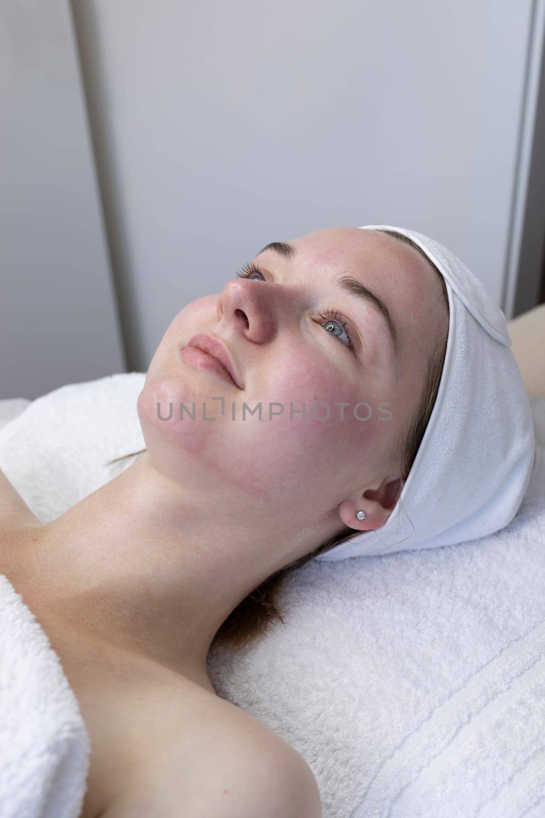 Portrait Happy Female Patient After Mesotherapy And Microneedling Treatment Lying on Couch In Beauty Saloon. Beauty Invasive Cosmetic Procedure Using Thin Needles Looking. Microdermabrasion, Vertical