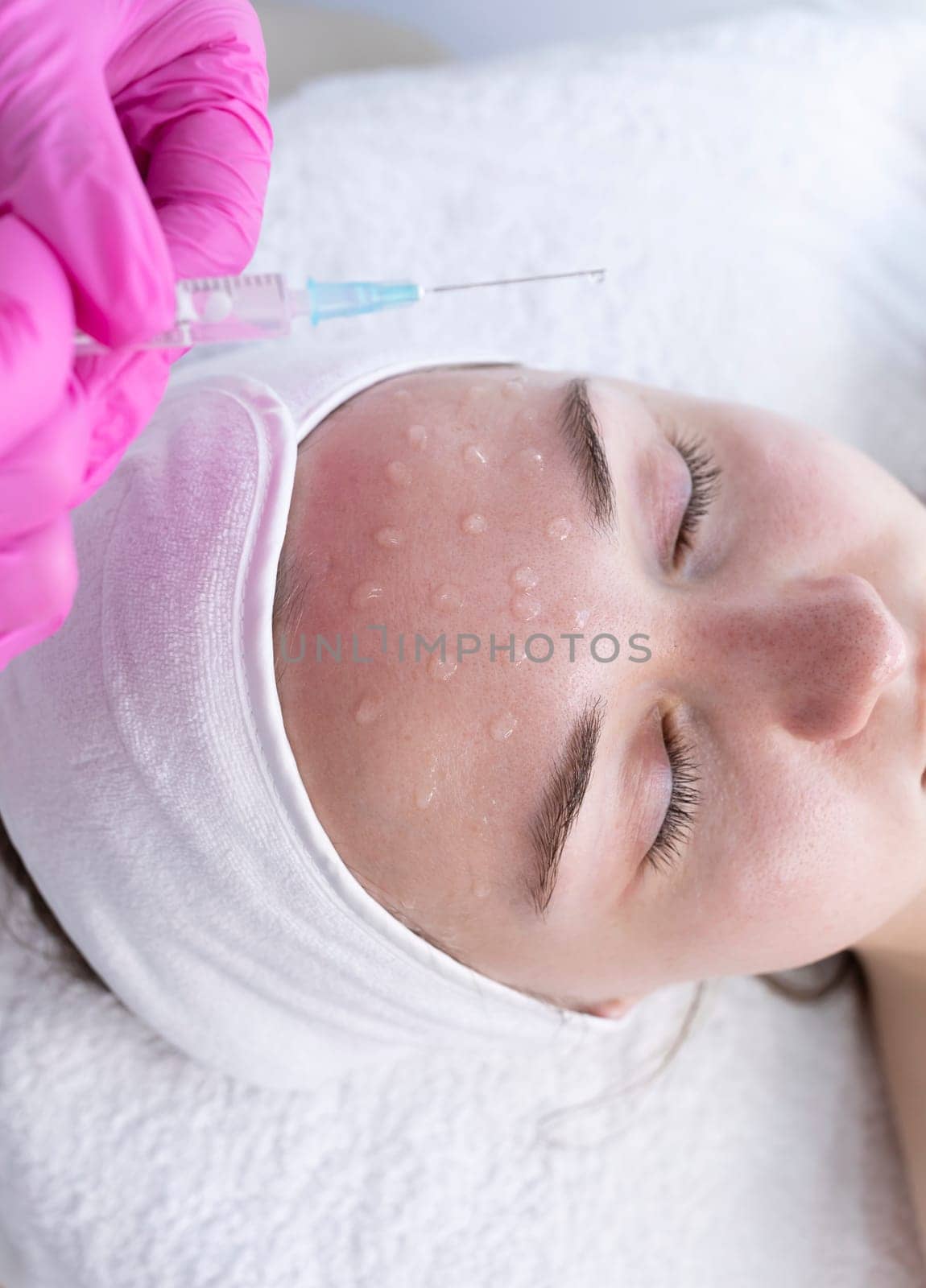 Cosmetologist Applying Peeling For Mesotherapy Injection With Dermapen On Forehead With Syringe, Face Of Young Woman For Rejuvenation In Spa. Patient Getting Needle Mesotherapy, Skincare. Vertical.