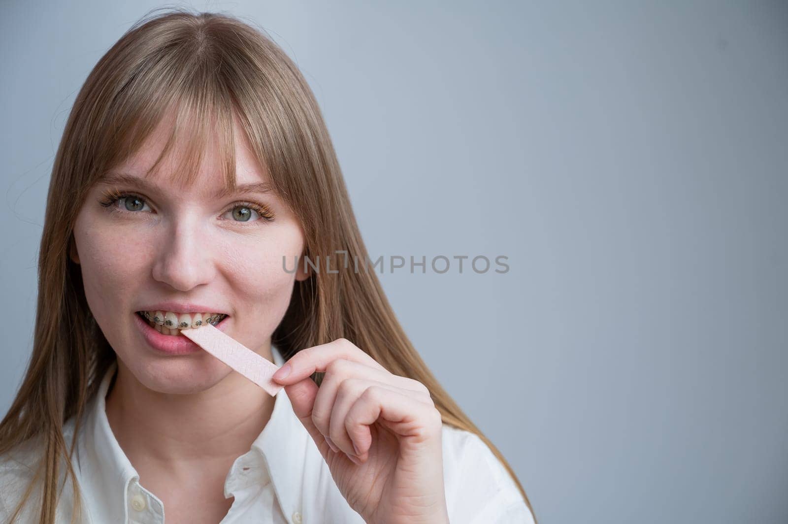 Young woman with metal braces on her teeth is chewing gum. Copy space