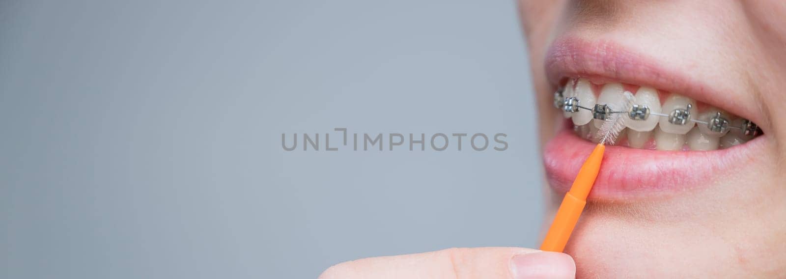 Unrecognizable Caucasian woman cleans braces with a brush. Widescreen