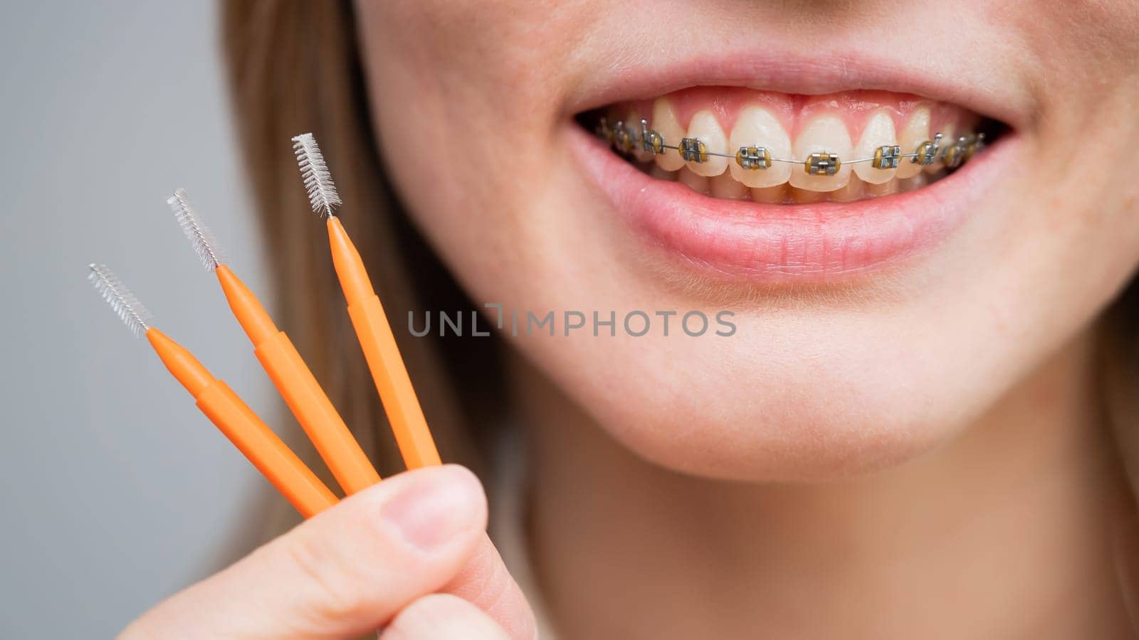 Close-up portrait of a woman with braces holding a floss to clean her teeth