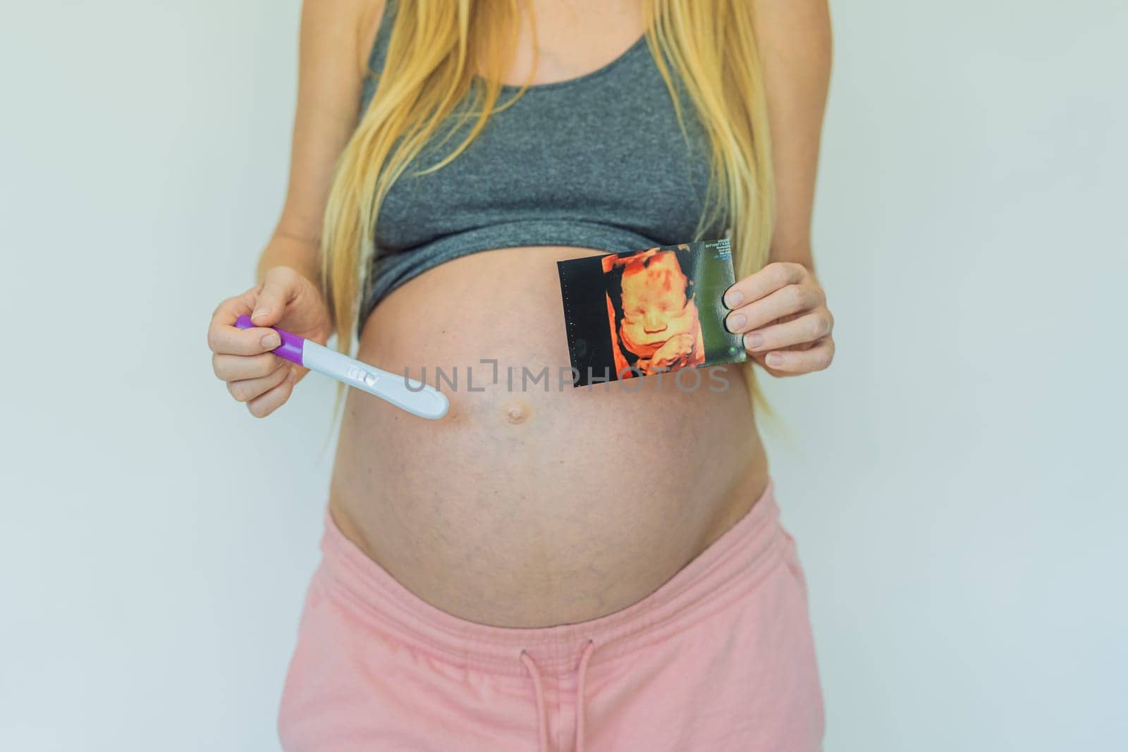 Joyful pregnant woman shares the exciting news, proudly displaying her positive pregnancy test and a heartwarming ultrasound photo.