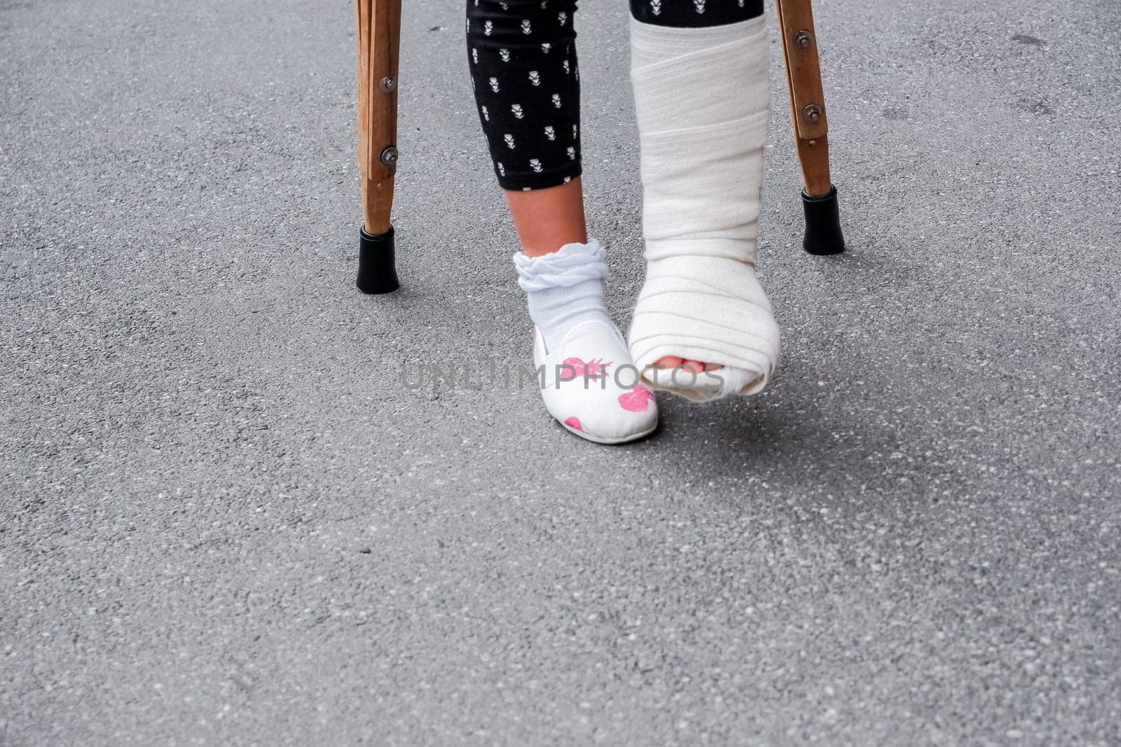 Little girl with crutches walking outdoor. Back to school.leg in cast.child on crutches with leg in a gypsum.Copy space.Never give up. girl on crutches. She broke her leg. by YuliaYaspe1979