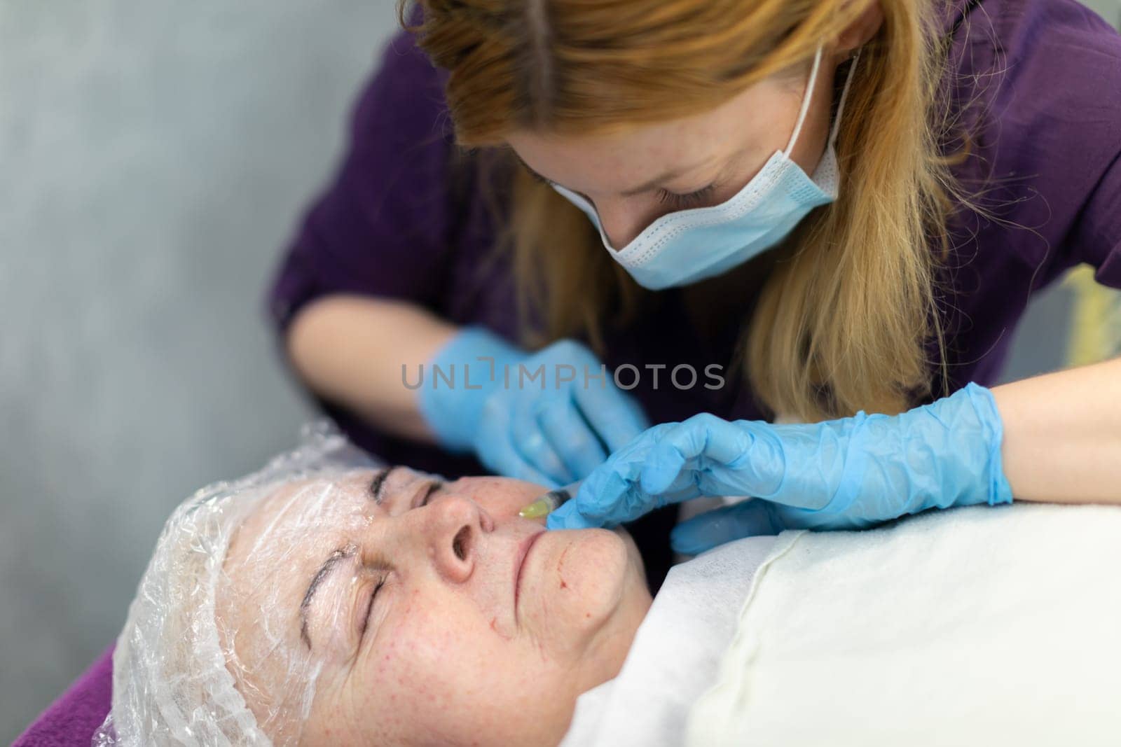 The cosmetologist is concentratedly making small, precise punctures on the patient's face. by fotodrobik