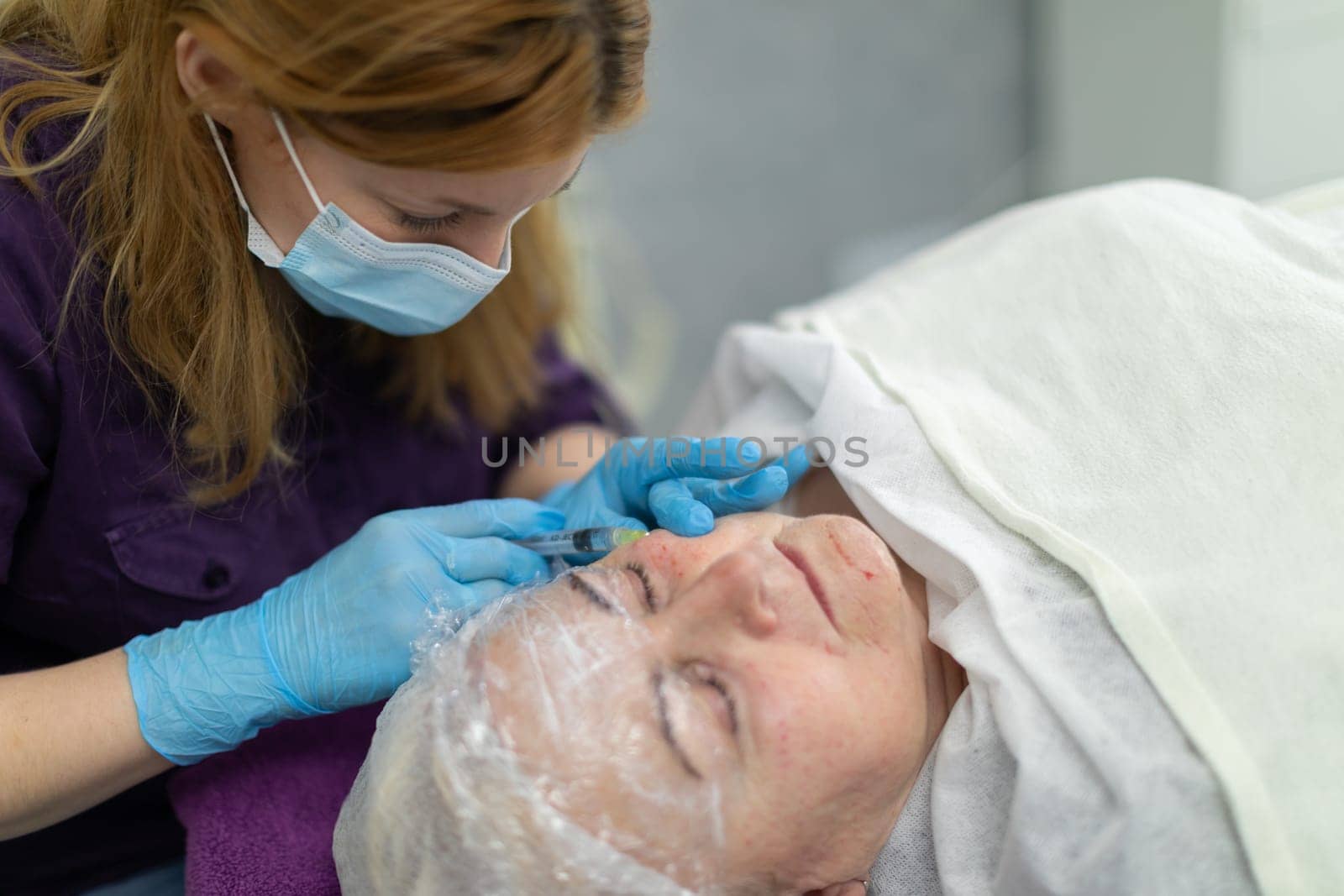 A patient of an aesthetic medicine clinic experiences a mesotherapy treatment. An overhead view of the woman lying down. Fresh injection marks can be seen on her face.