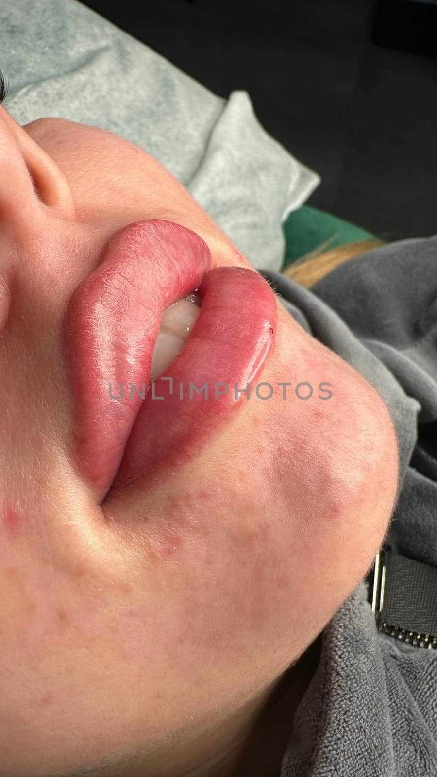 Lush, plump lips. by SmirMaxStock