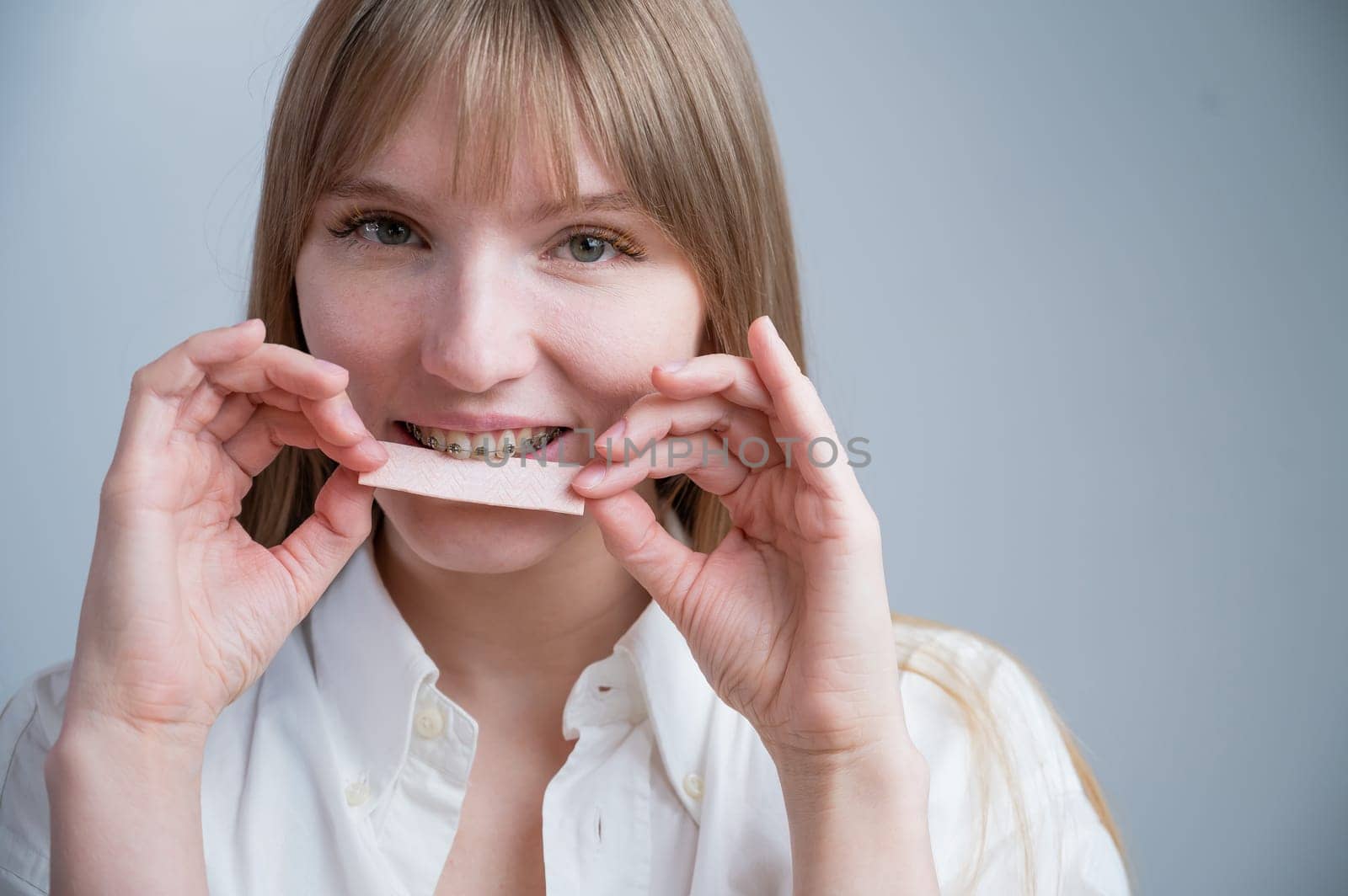 Young woman with metal braces on her teeth is chewing gum. The girl is eating gummy candy.