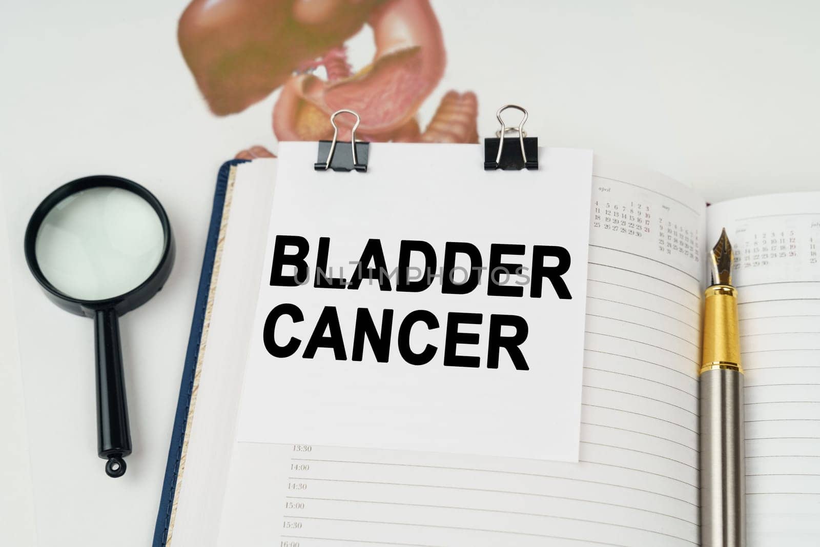 On the table there is a magnifying glass and a notepad with the inscription - Bladder cancer by Sd28DimoN_1976