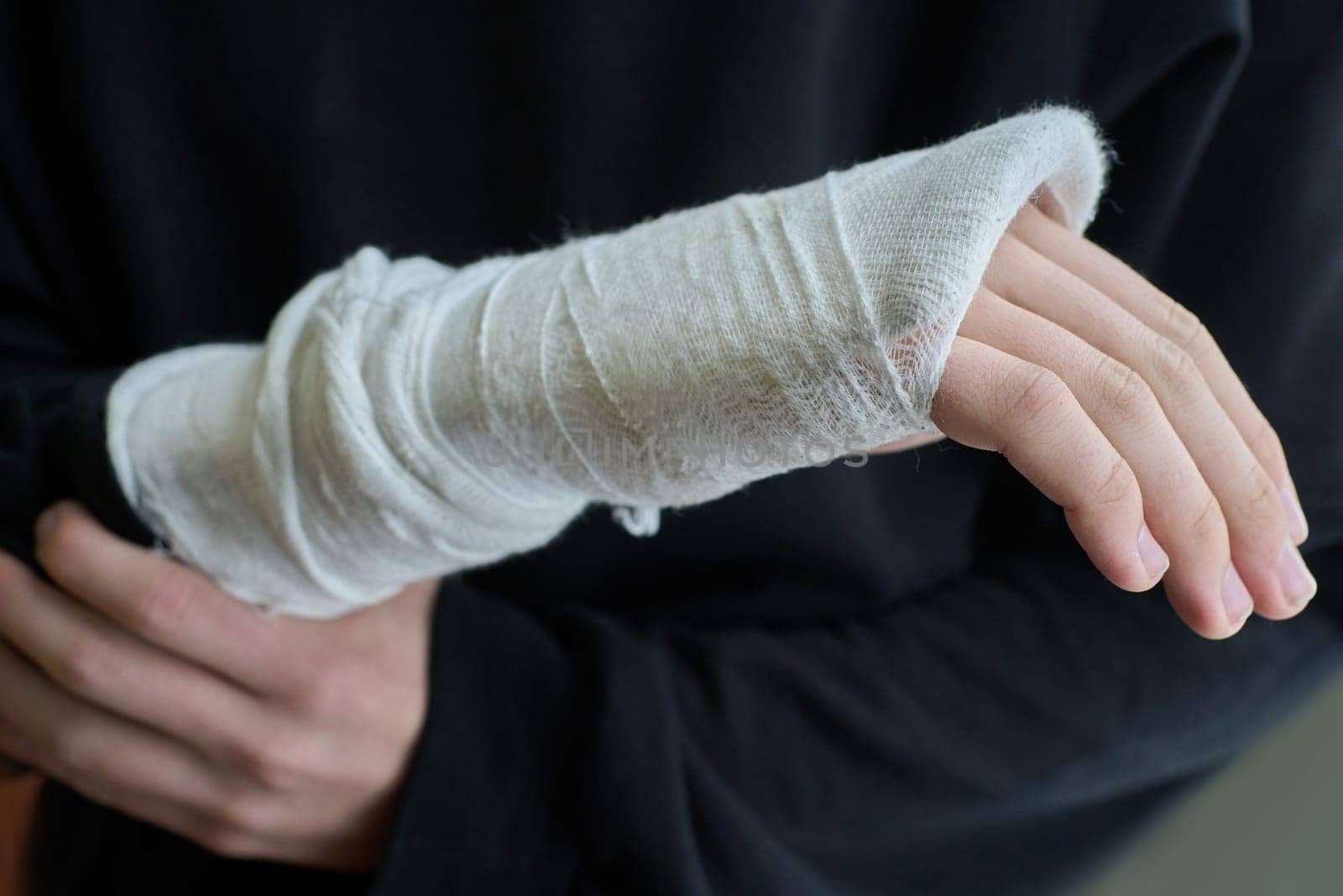 Close-up of a broken arm of a child in a cast.
