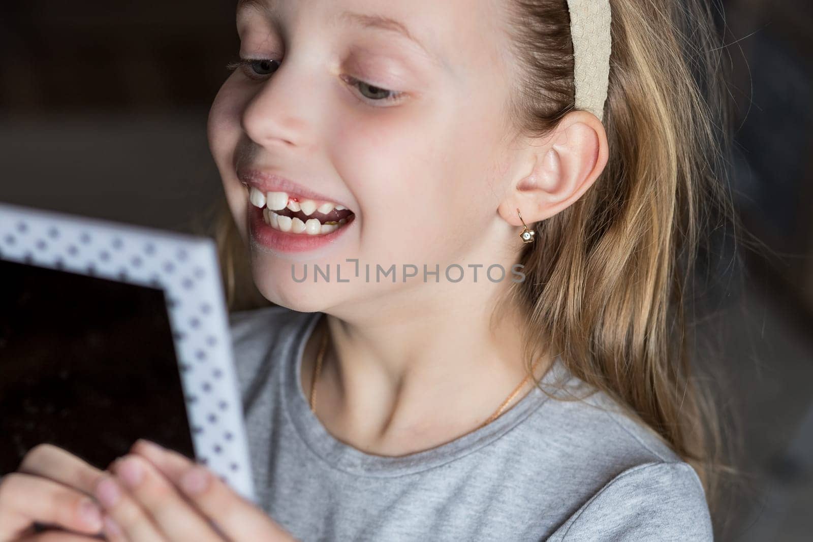 Female kid with opened mouth pointing at missing front baby tooth with finger smiling excitedly in yellow t-shirt on white background.