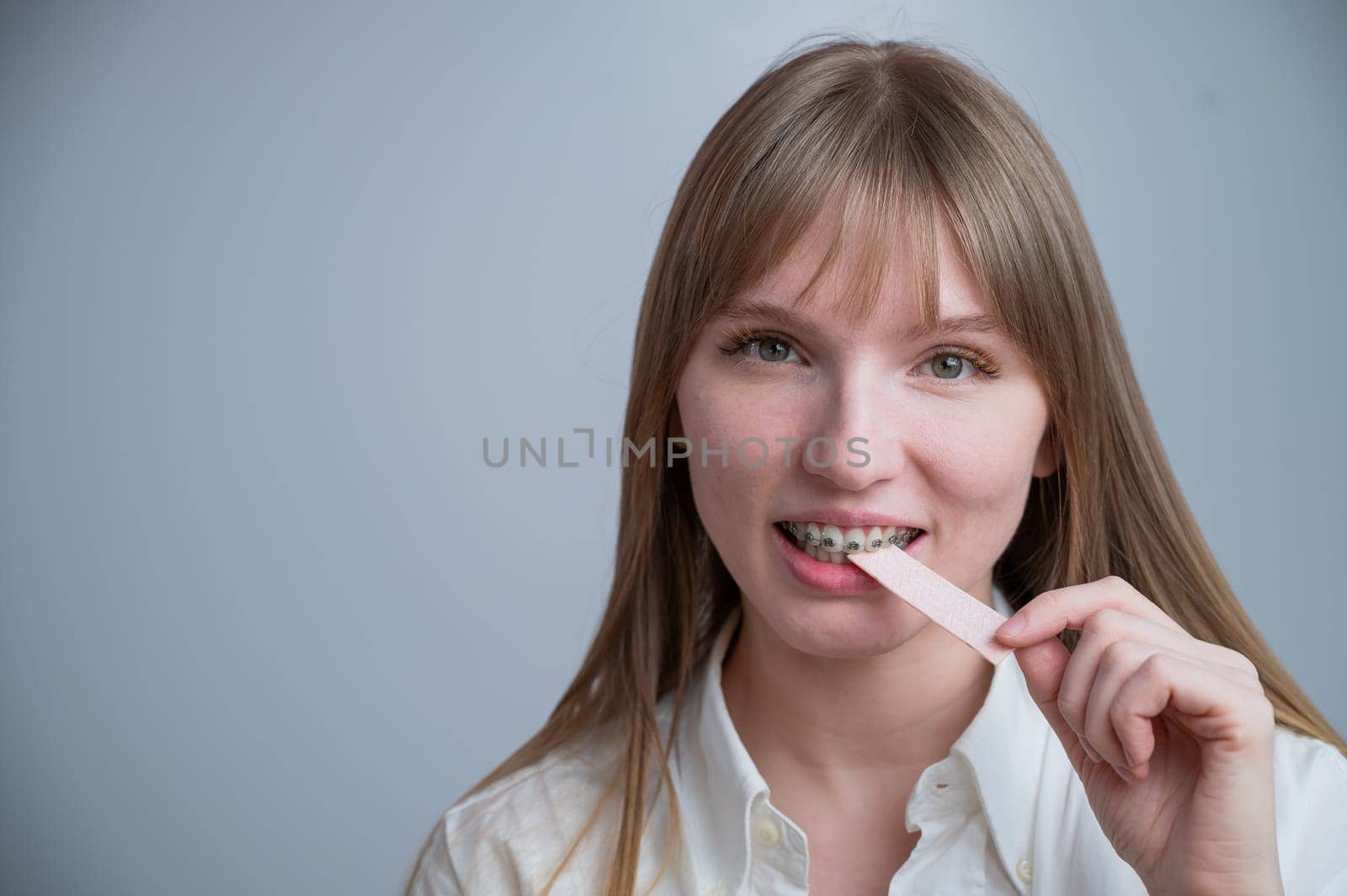 Young woman with metal braces on her teeth is chewing gum. Copy space