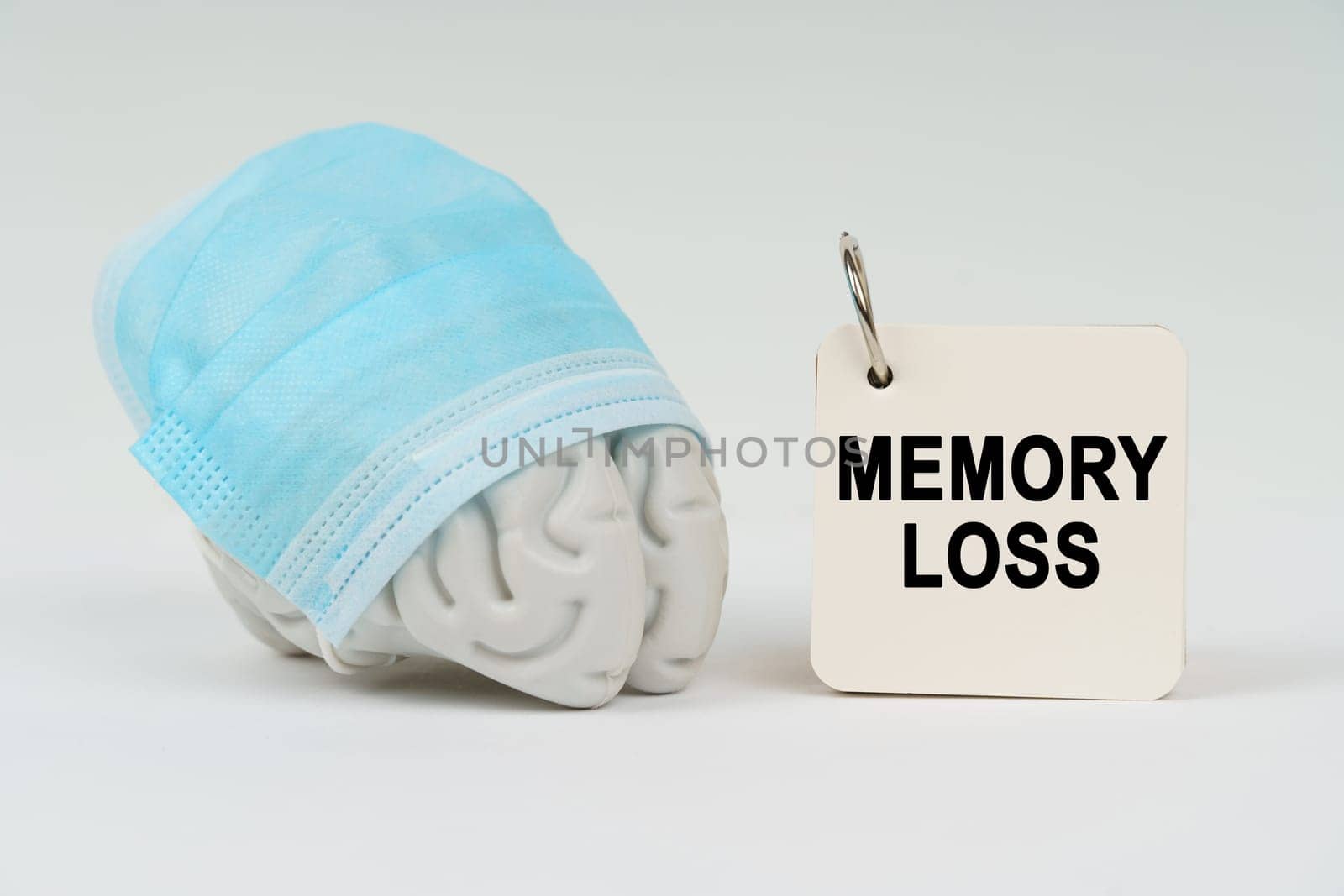 Medical concept. On a white surface next to the brain there is a notepad with the inscription - MEMORY LOSS