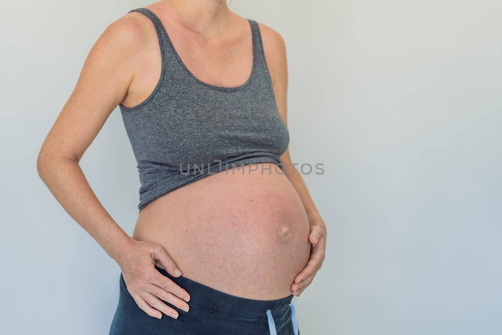 Expectant woman with sunburned, red skin, highlighting the importance of sun protection during pregnancy by galitskaya