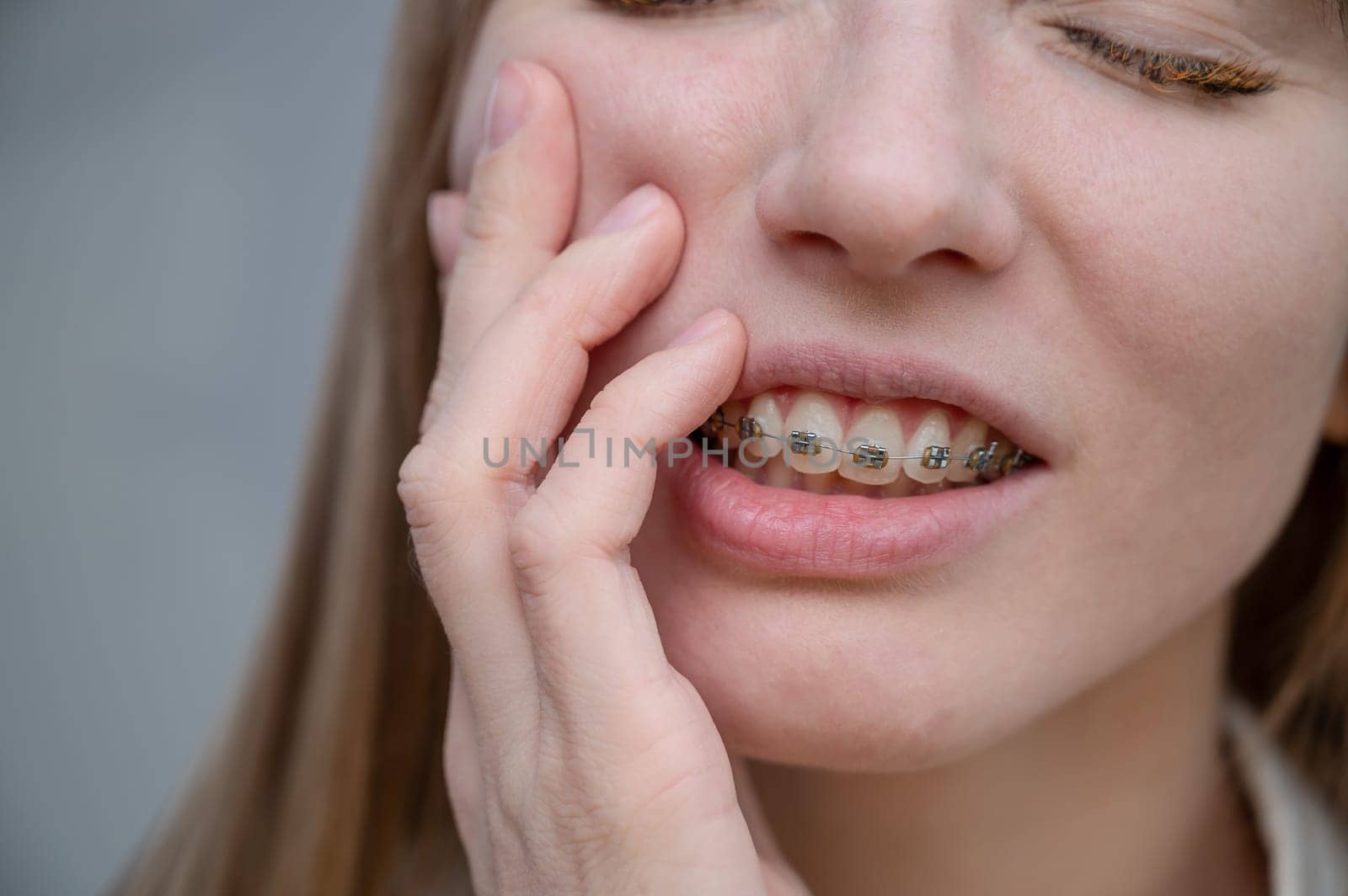 Close-up portrait of a red-haired girl suffering from pain due to braces. Young woman corrects bite with orthodontic appliance