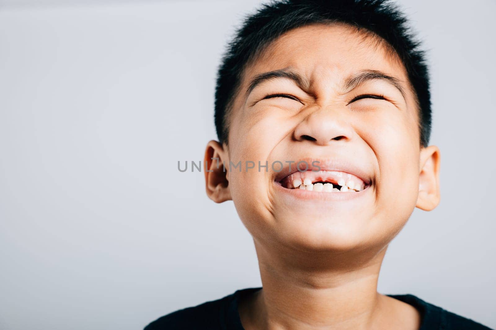 Kid without upper tooth smiles wide gap seen. Child dental growth isolated on white. Joyful tooth fairy moment. Children show teeth new gap, dentist problems. little boy no tooth