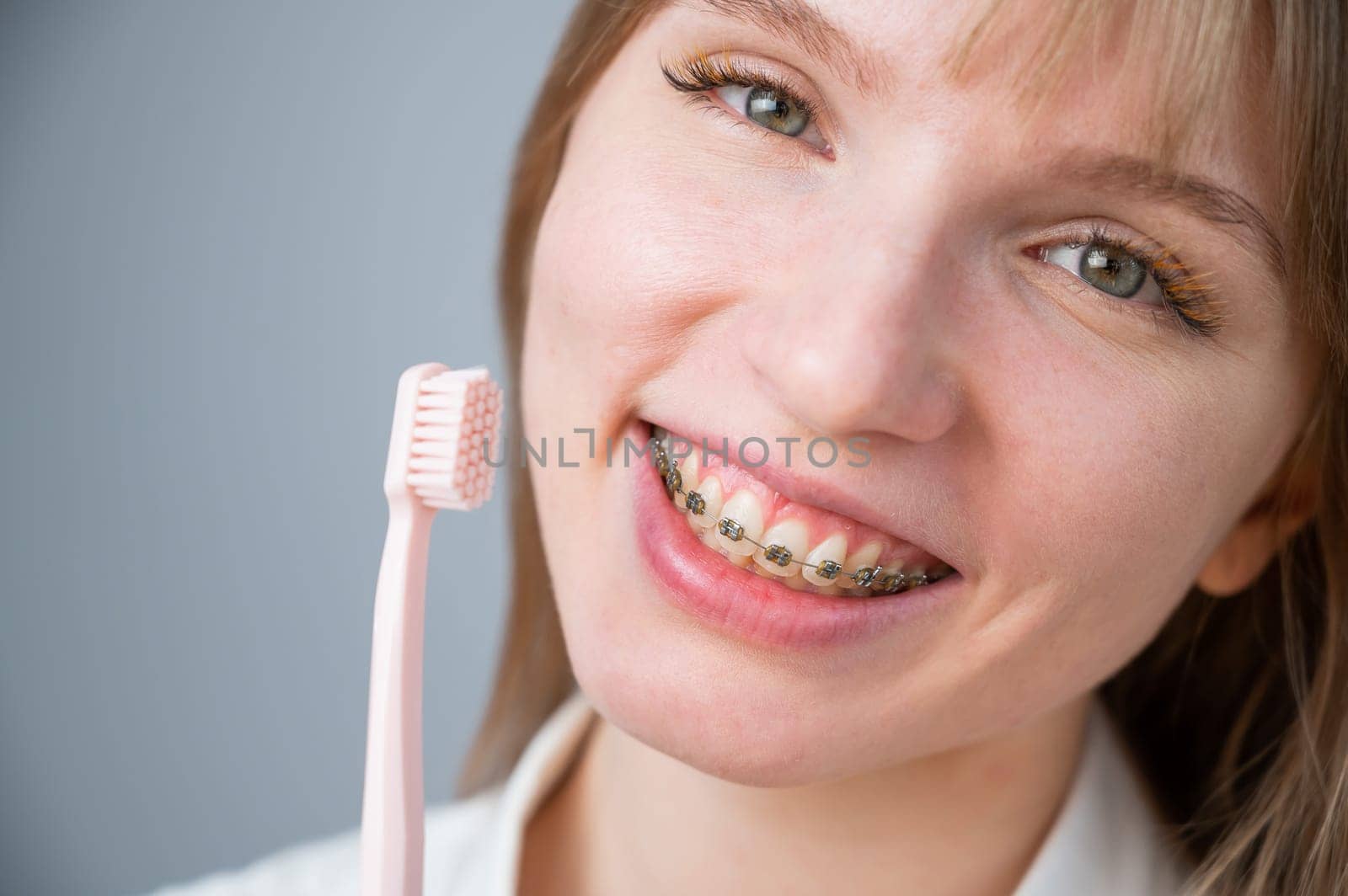 Portrait of a caucasian woman with braces on her teeth holding a toothbrush. by mrwed54