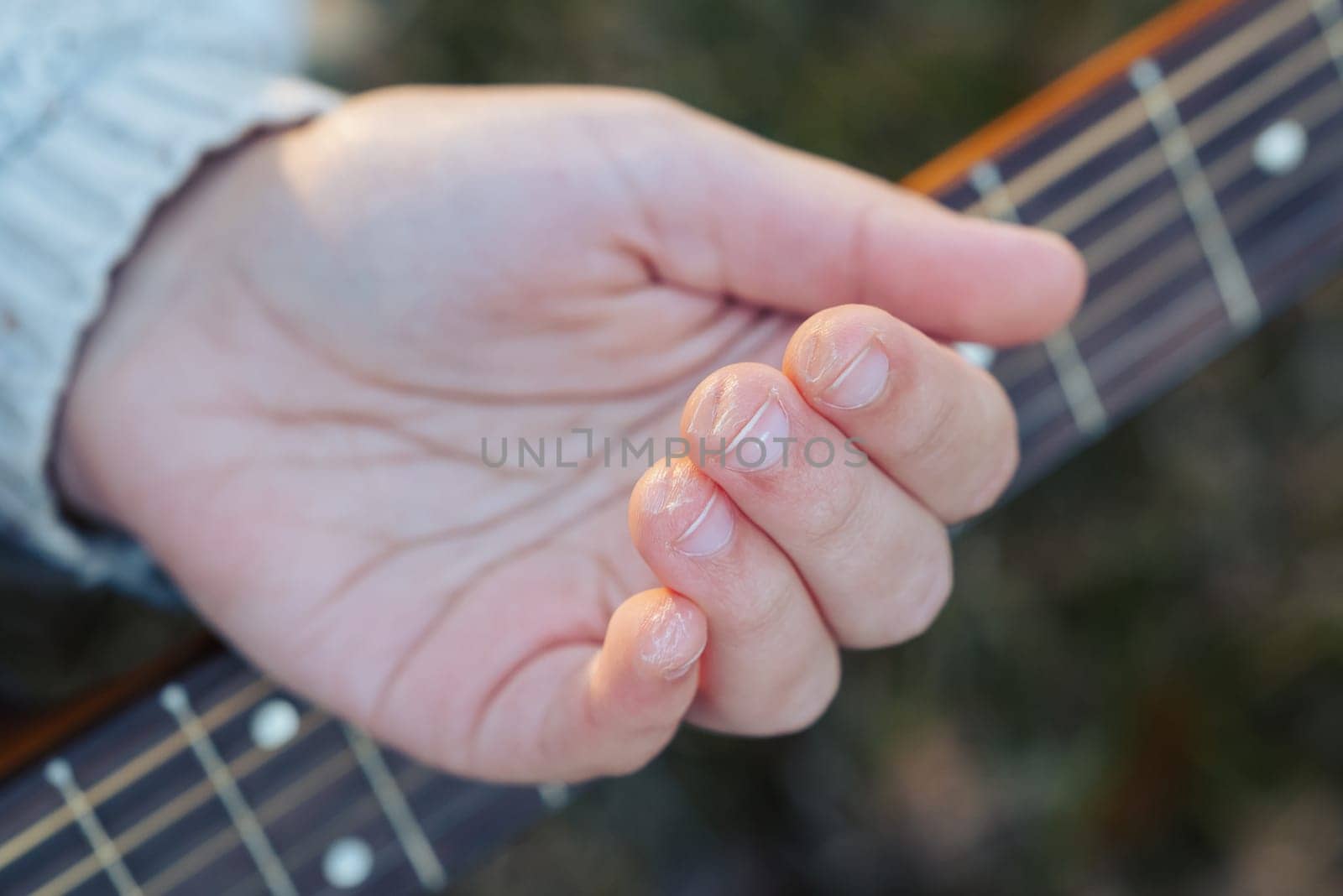Marks of strings on woman girl guitarist after long hours of playing