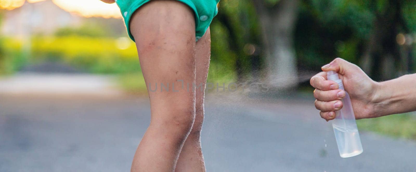 Mom sprays her child with mosquito repellent. Selective focus. by yanadjana