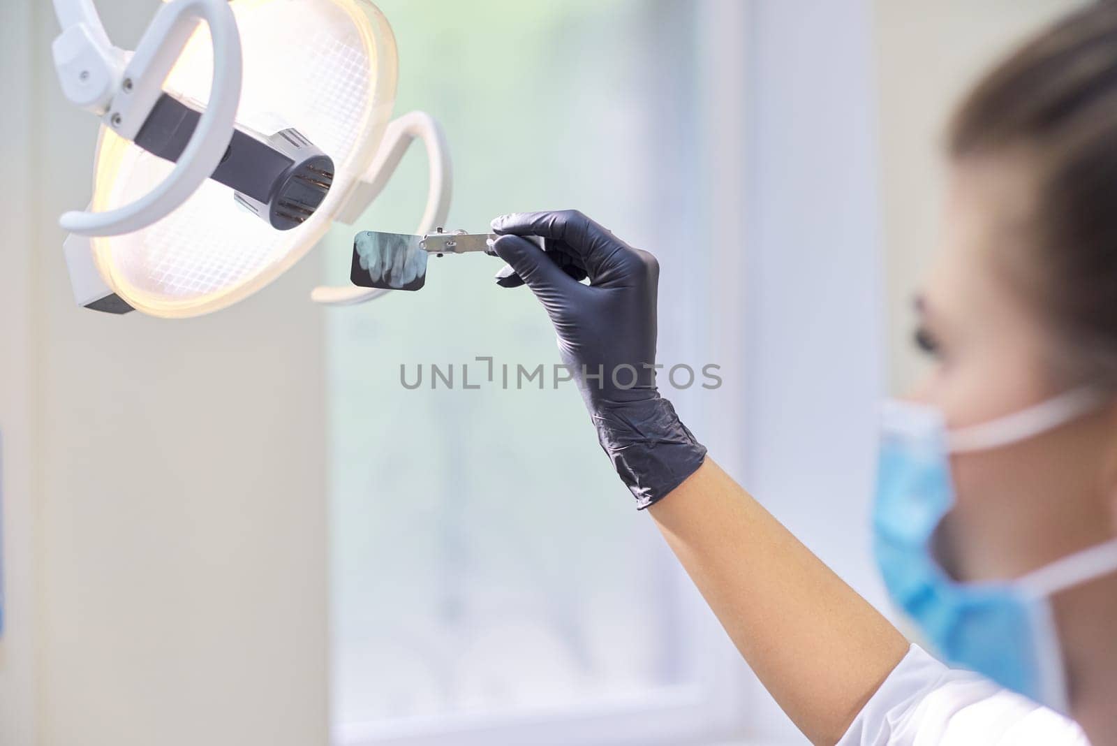 Close-up dental x-ray shot of teeth in the hands of dentist doctor at clinic