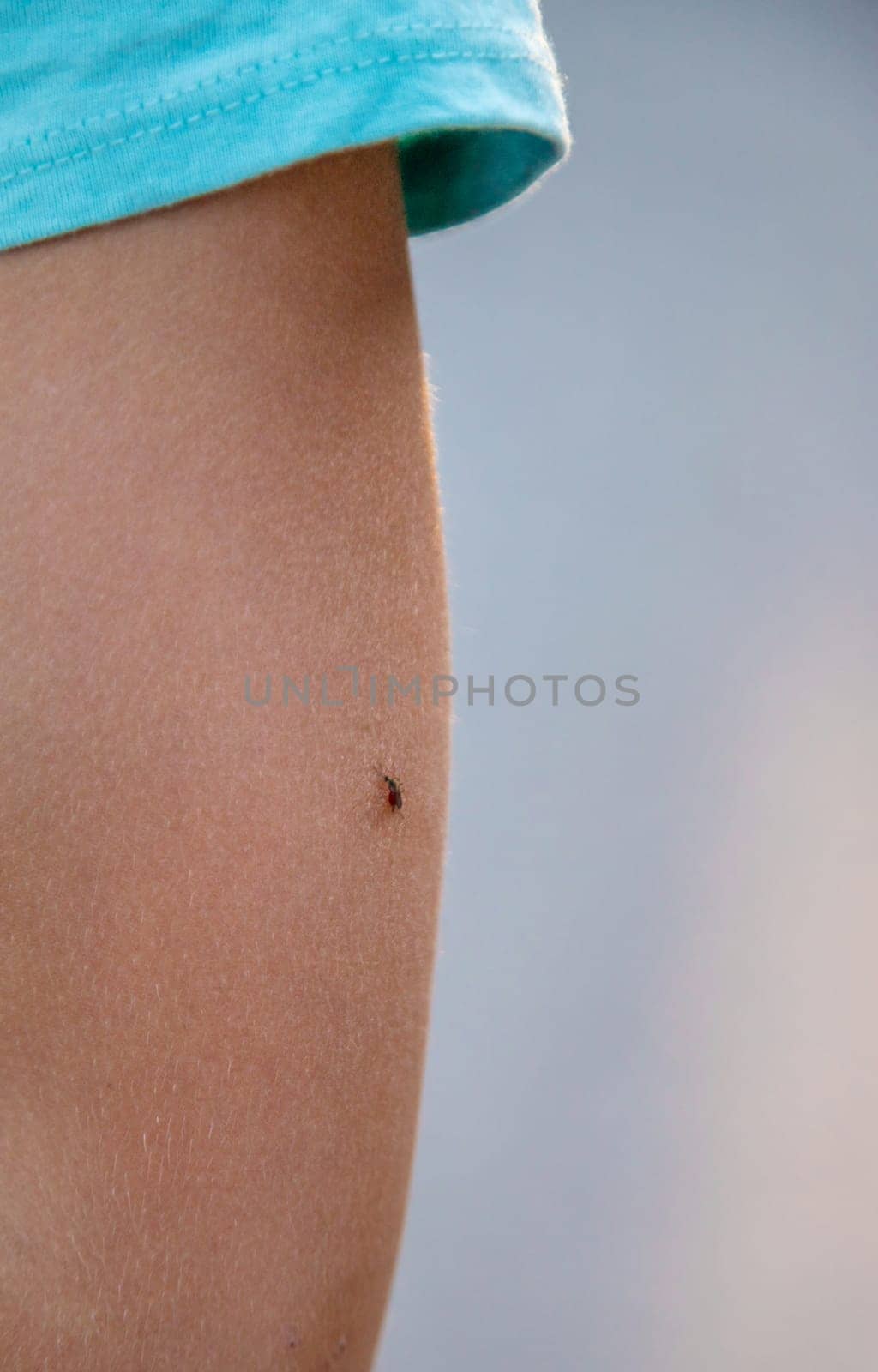 A mosquito on a child hand. Selective focus. by yanadjana