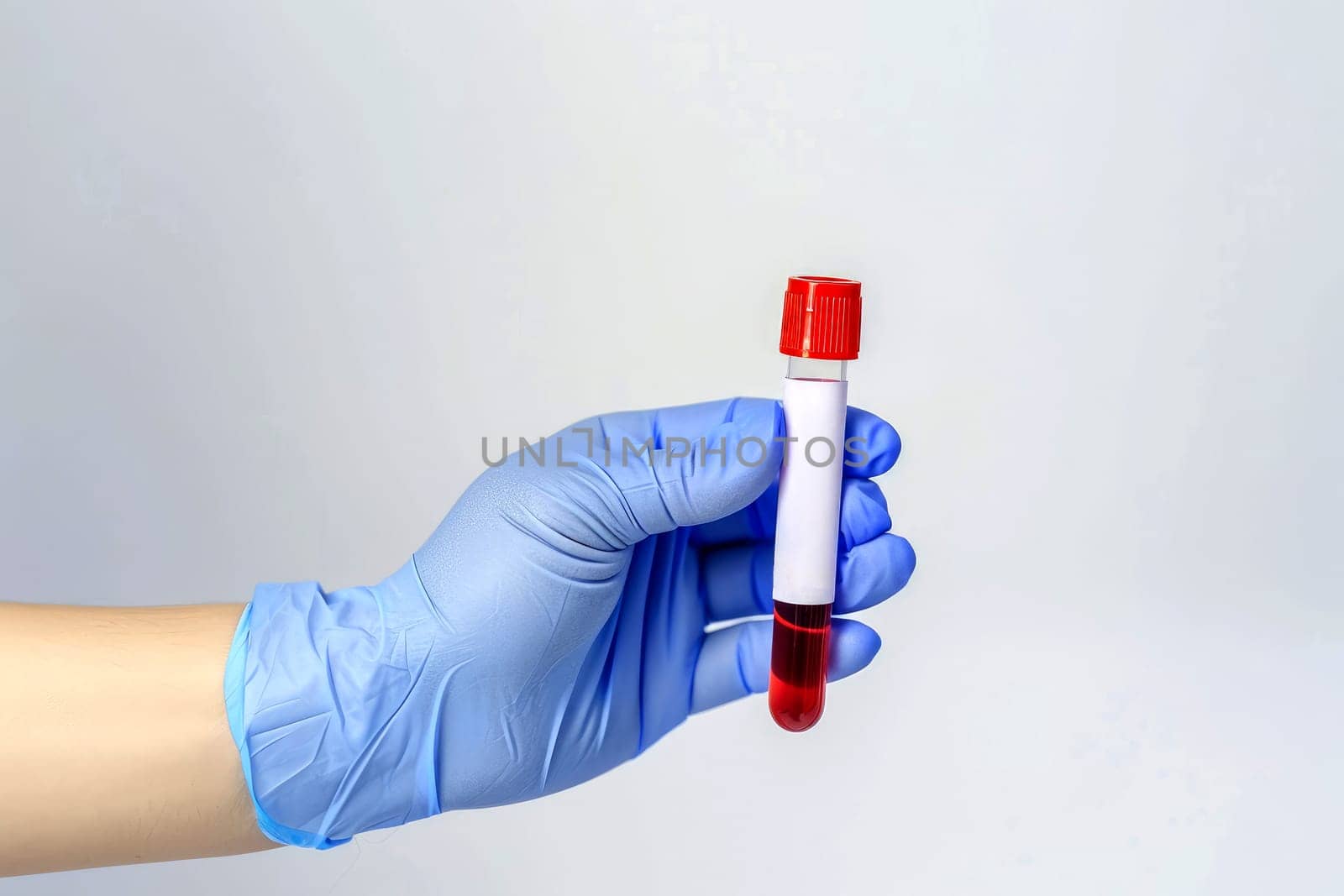 Doctor holding blood tube test in the research laboratory. health for check up . Generative ai.