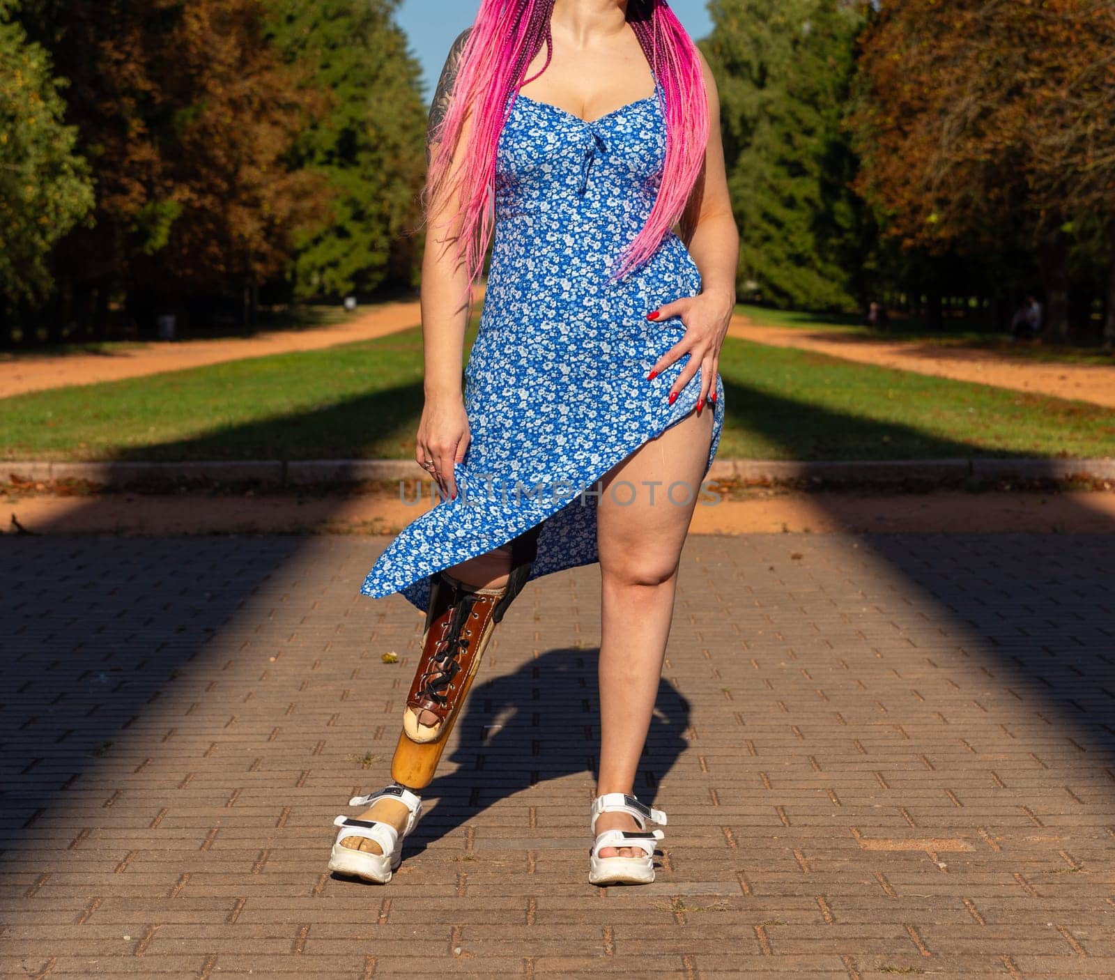Beautiful young woman leg amputee in a dress walking in park at sunny day. by BY-_-BY