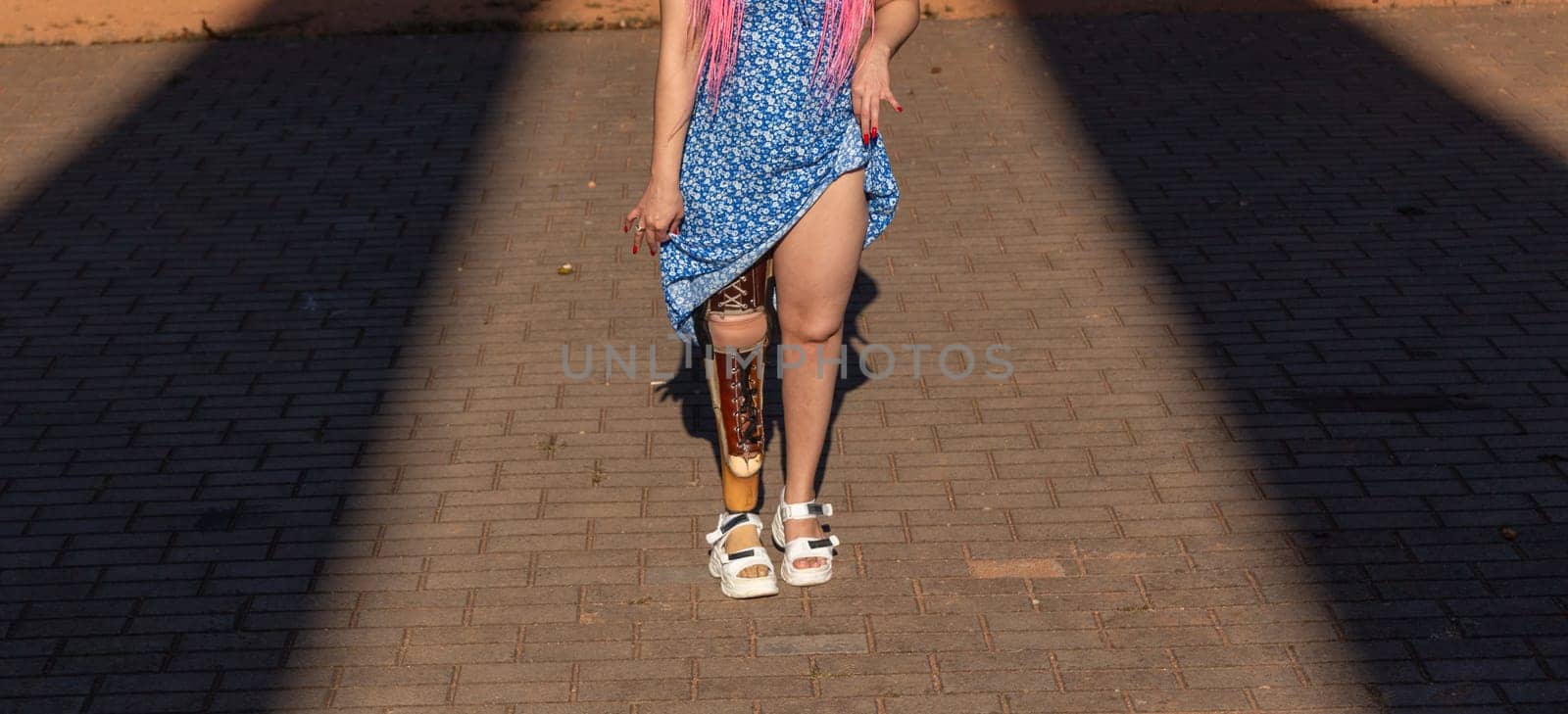 Beautiful young woman leg amputee in a dress walking in park at sunny day. Life goes on no matter what.