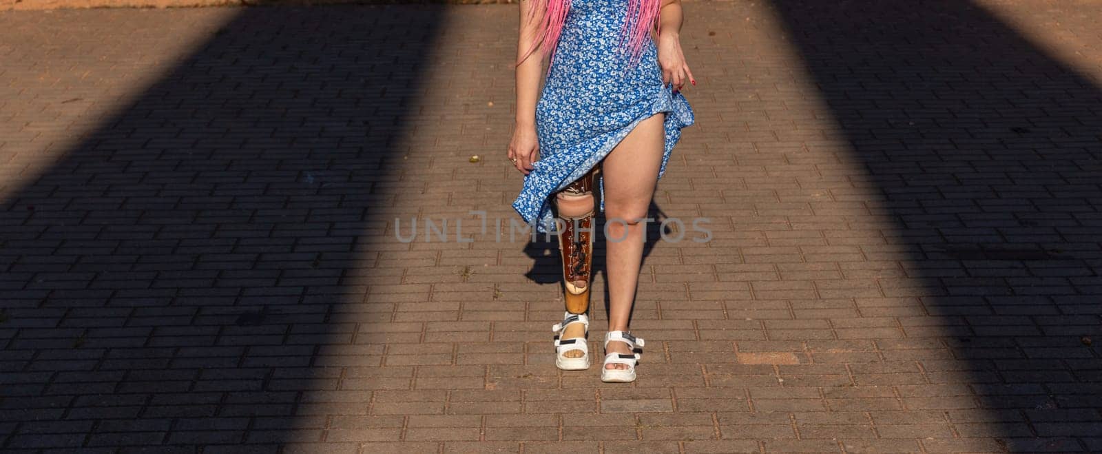 Beautiful young woman leg amputee in a dress walking in park at sunny day. Life goes on no matter what.