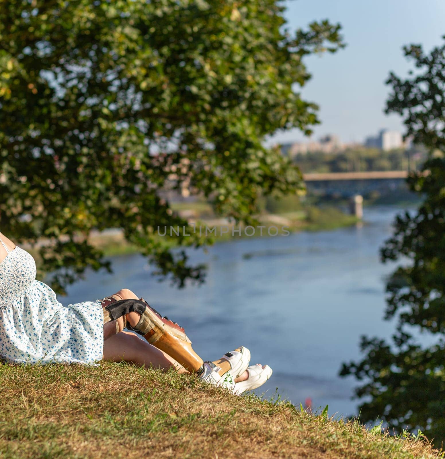 Beautiful young woman leg amputee in a dress walking in park near by river at sunny day. by BY-_-BY