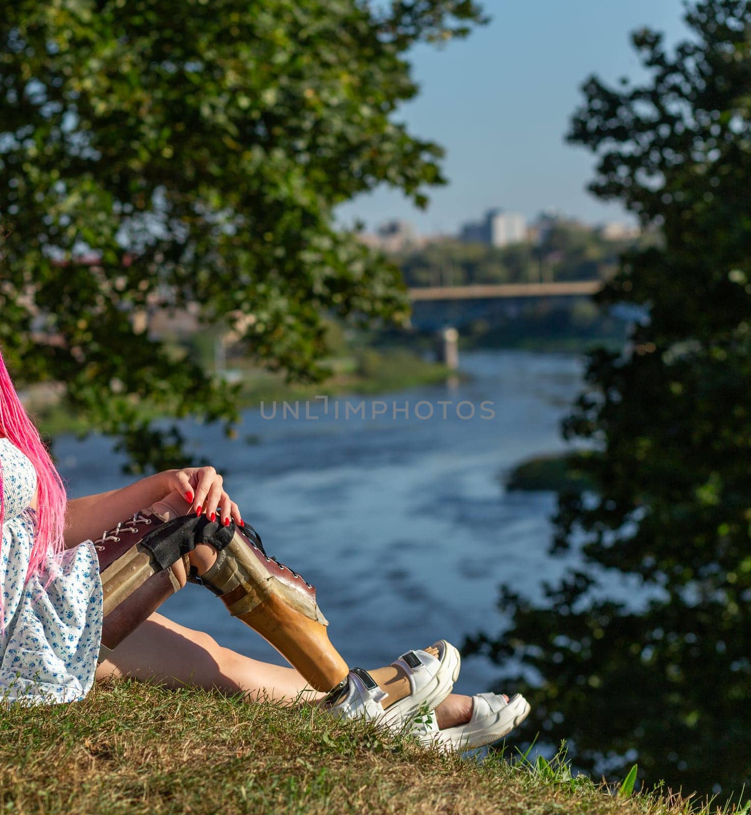 Beautiful young woman leg amputee in a dress walking in park near by river at sunny day. Life goes on no matter what.