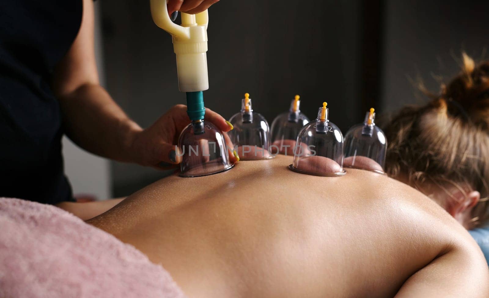 Massage Therapist Doing Back Vacuum Massage With Cups In Spa by GekaSkr