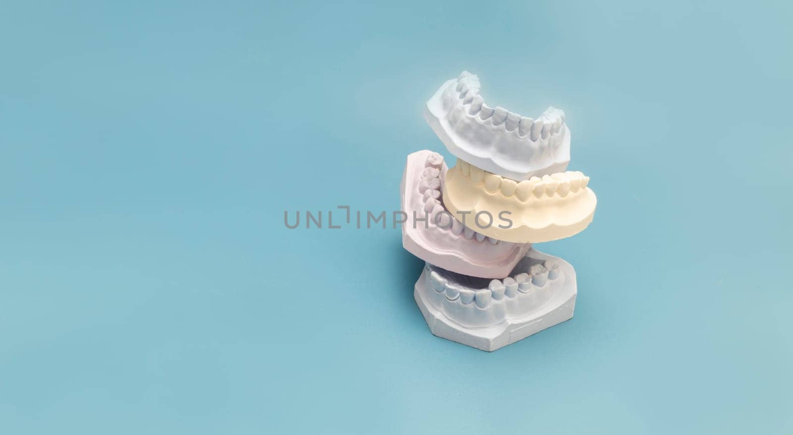 Mockup Many Die Stone, Plaster Cast Molds Of The Upper And Lower Jaws And Teeth With Pliable Imprint In Lab On Blue Background. Denture. Dental Gypsum Model, Space for Text. Prosthetics. Horizontal. by netatsi