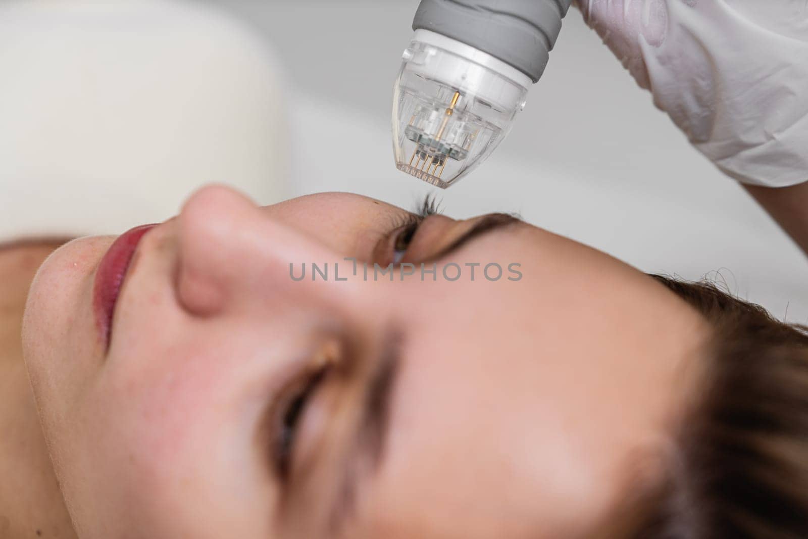 A woman is undergoing a laser treatment on her eye, with the help of a specialist ensuring safety and precision.