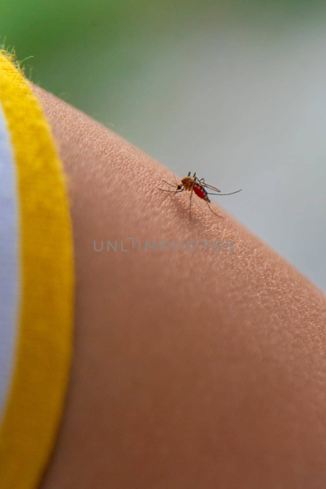 A mosquito on a child hand. Selective focus. kid.