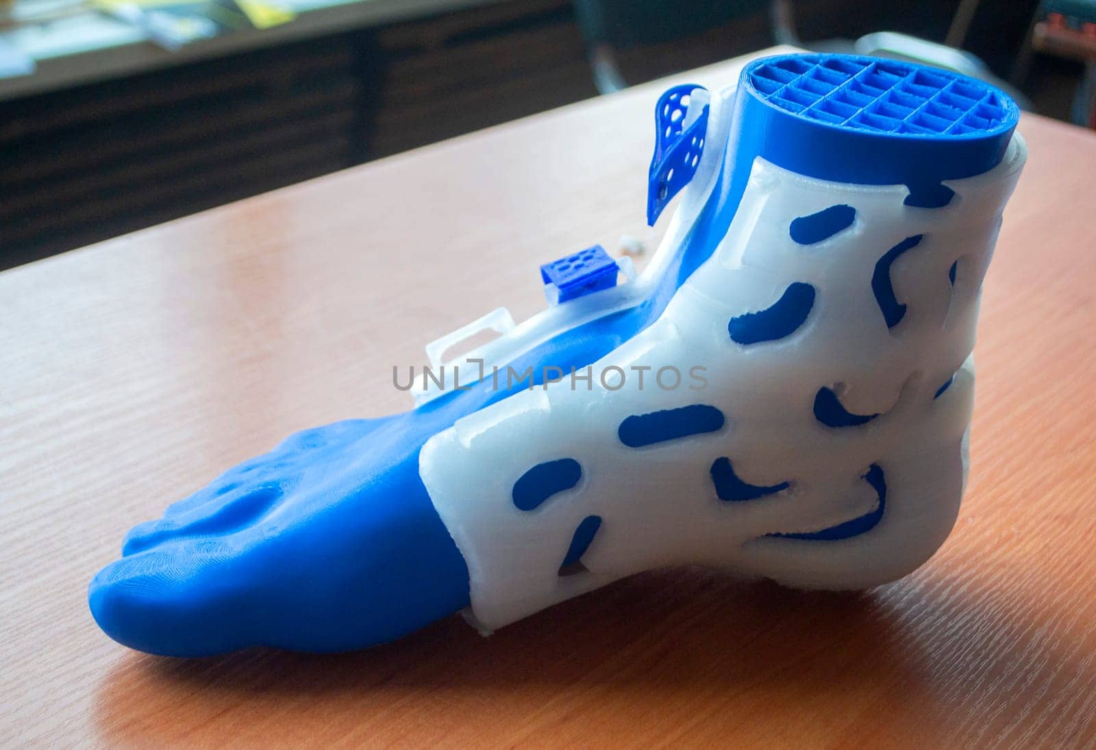 Medicine splint corset prosthesis langet for foot and model human foot printed on 3D printer from molten plastic. Medical orthosis, fixator, plastic overlay for leg and human leg created on 3D printer