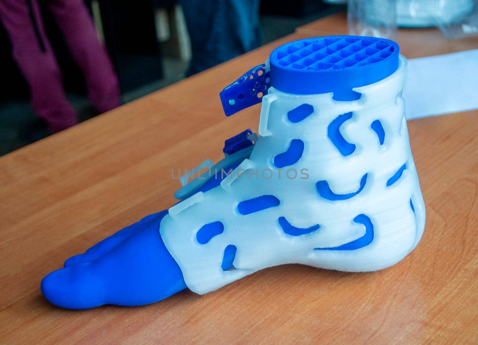 Medicine splint corset prosthesis langet for foot and model human foot printed on 3D printer from molten plastic. Medical orthosis, fixator, plastic overlay for leg and human leg created on 3D printer
